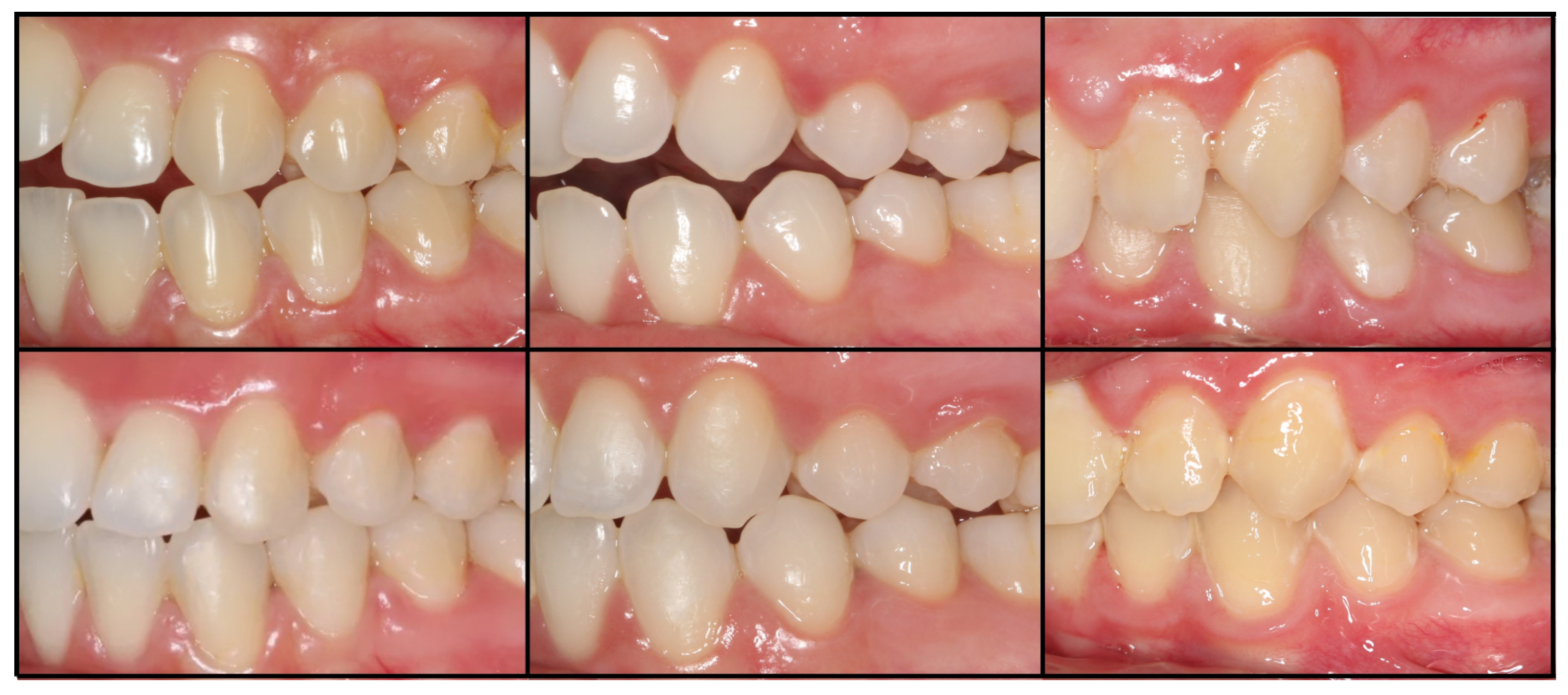 Coatings 13 01447 g001