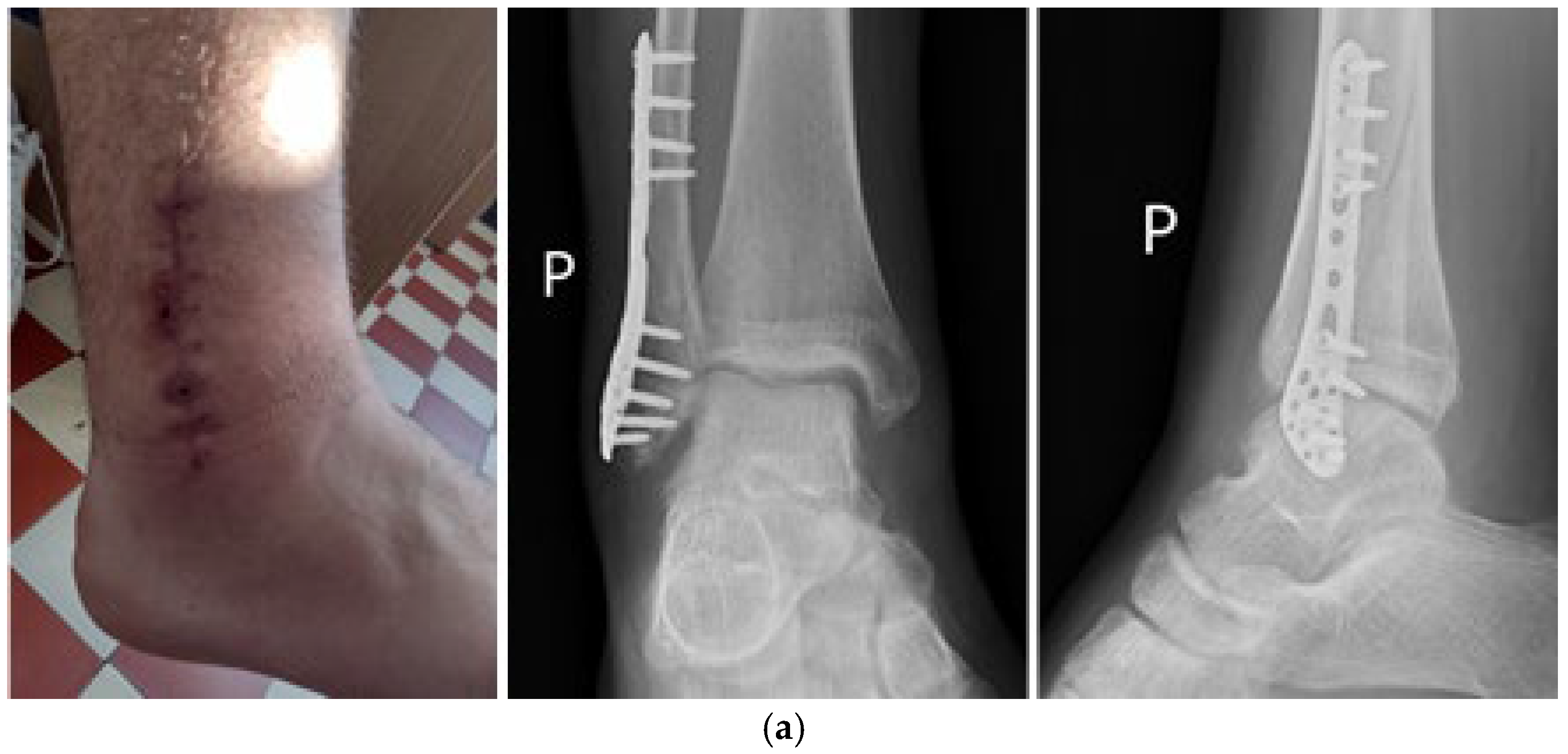 Coatings 15 00361 g003a