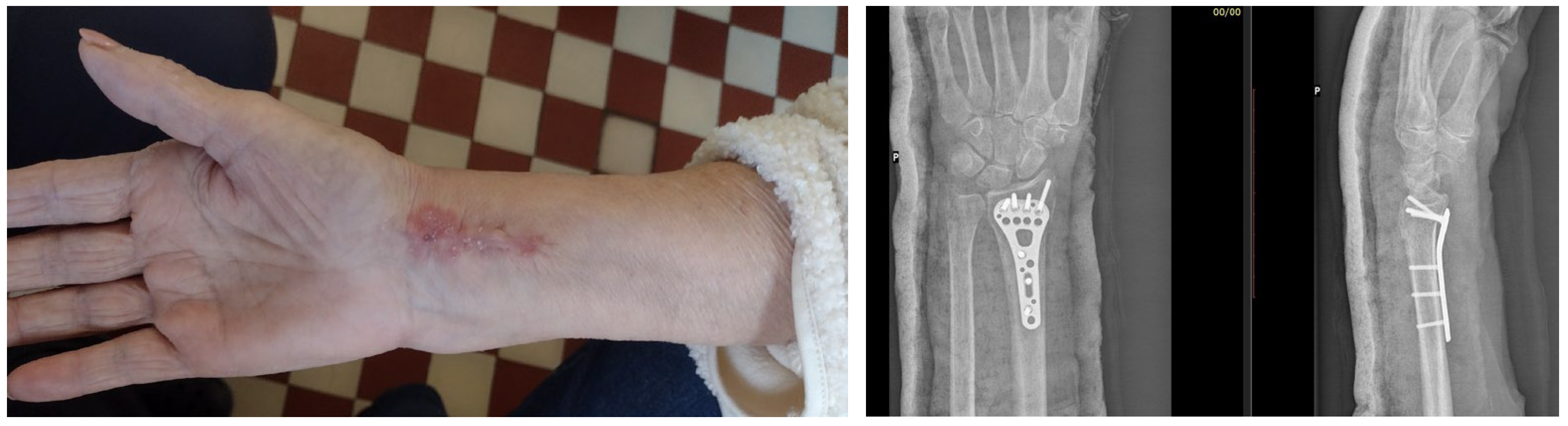 Coatings 15 00361 g004