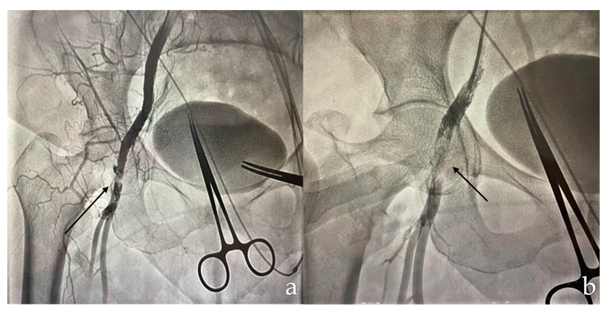 Complications 01 00007 g001