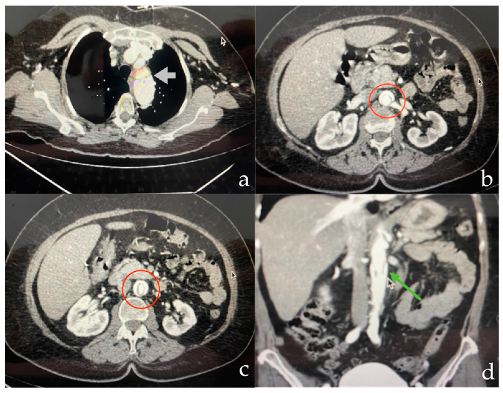 Complications 01 00007 g002