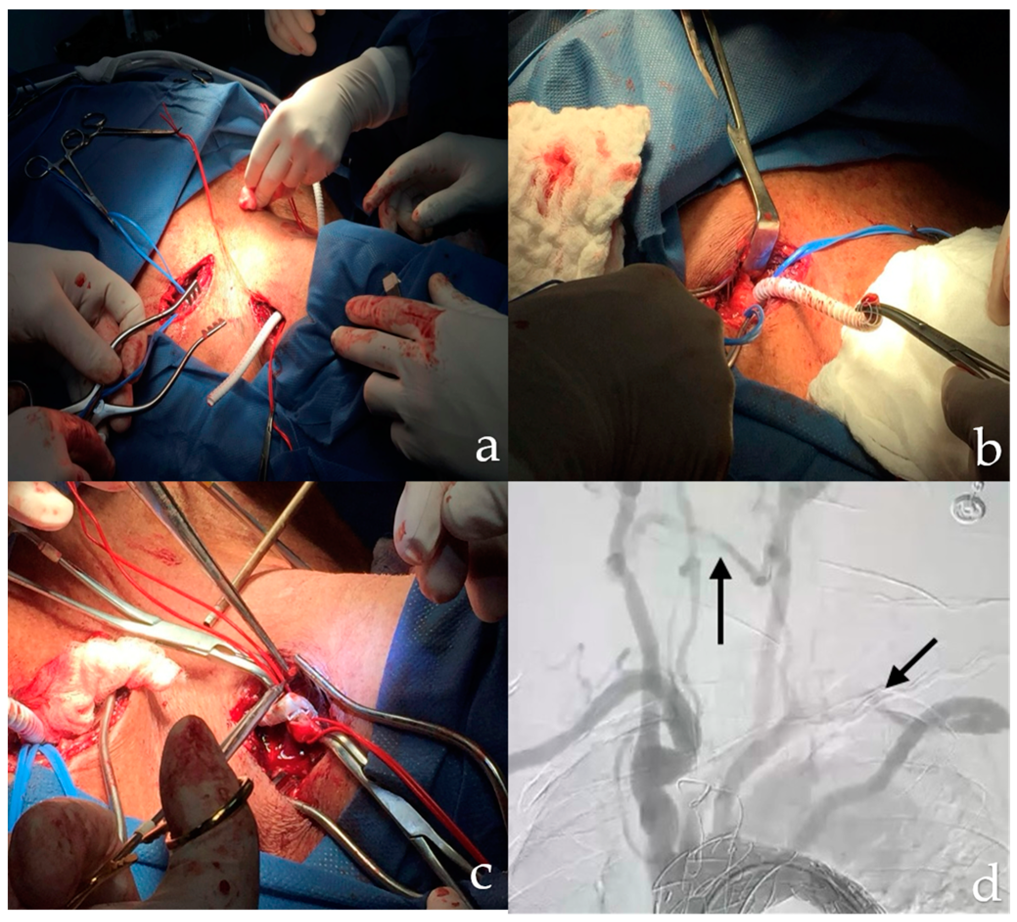 Complications 01 00007 g003