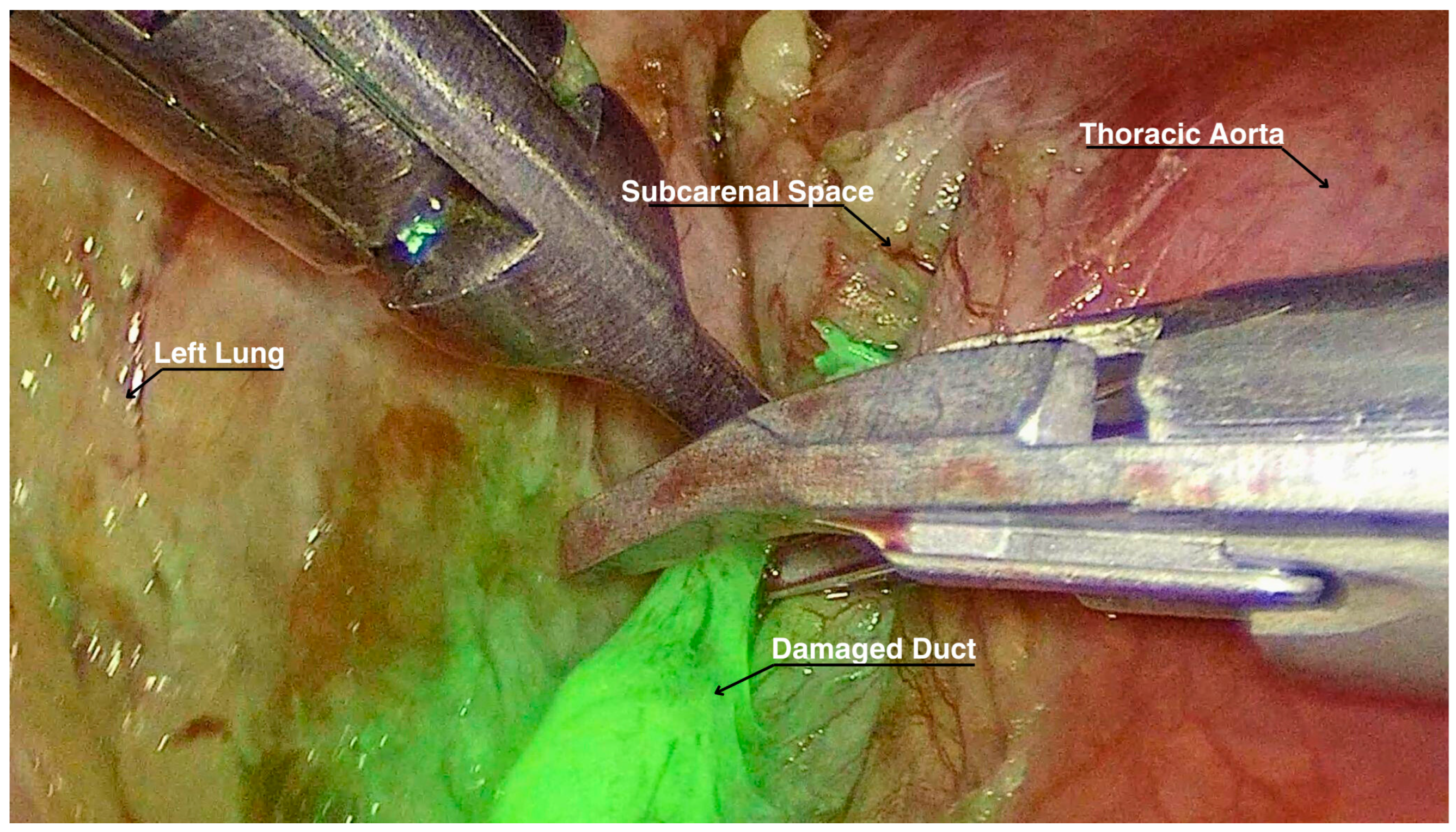 Complications 01 00012 g001