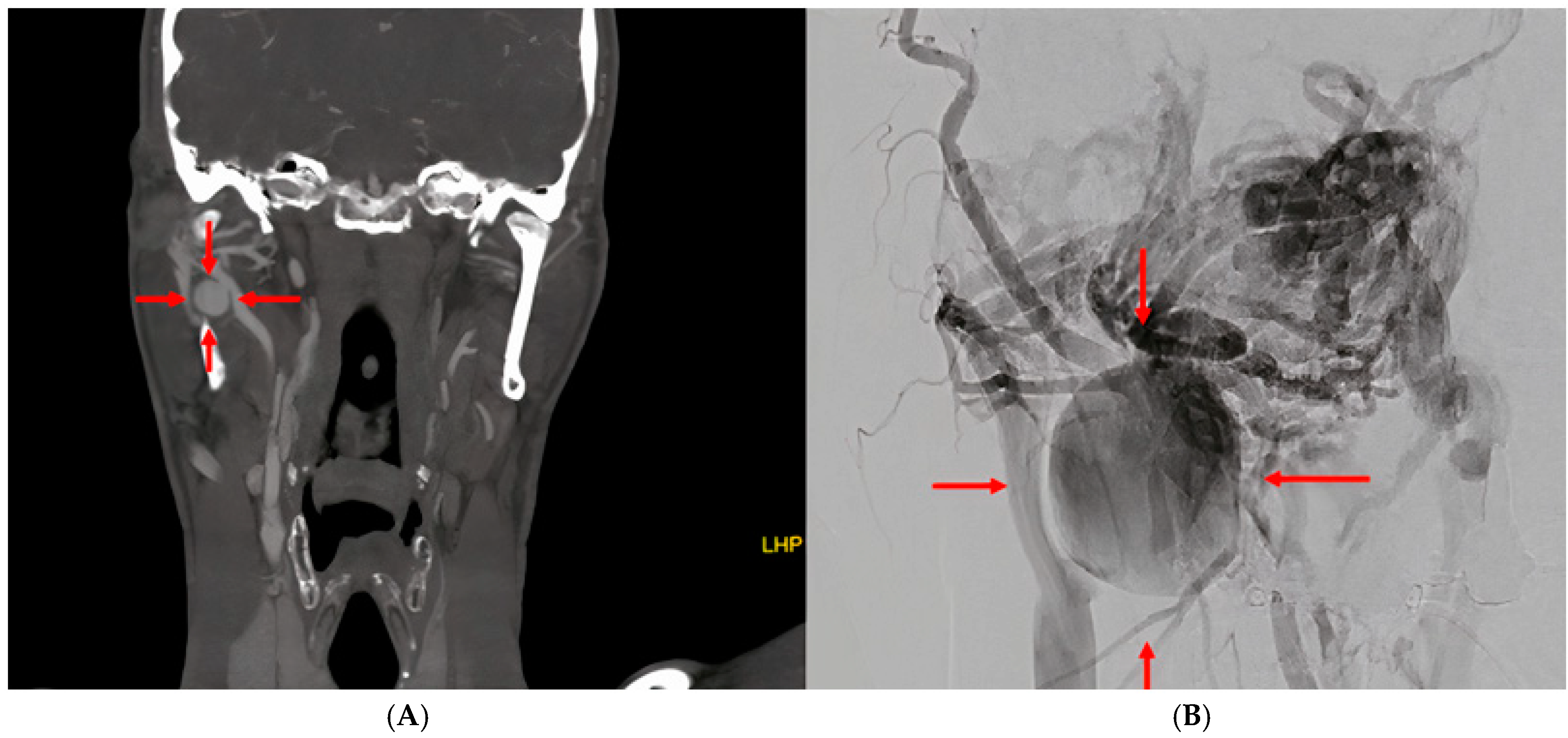 Complications 02 00003 g002