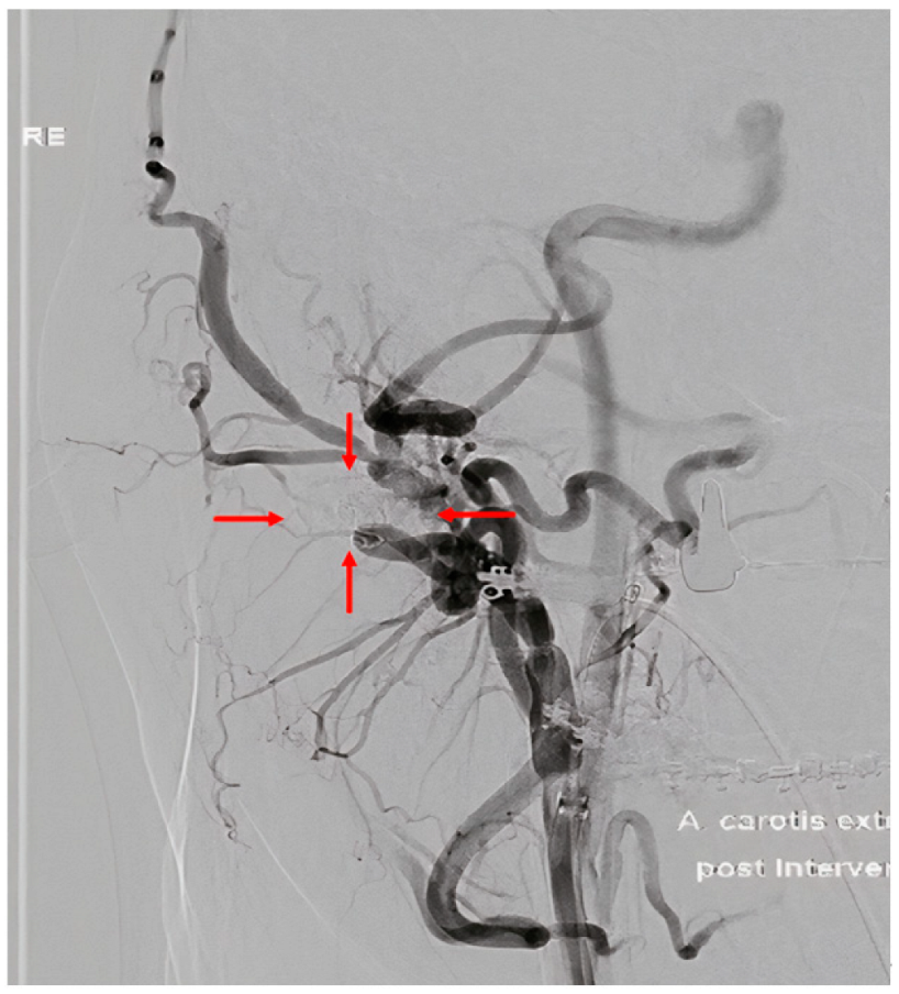 Complications 02 00003 g003