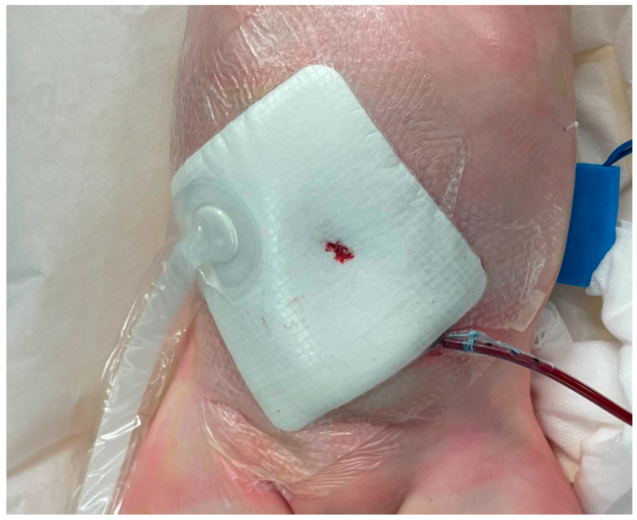 Complications 02 00004 g002