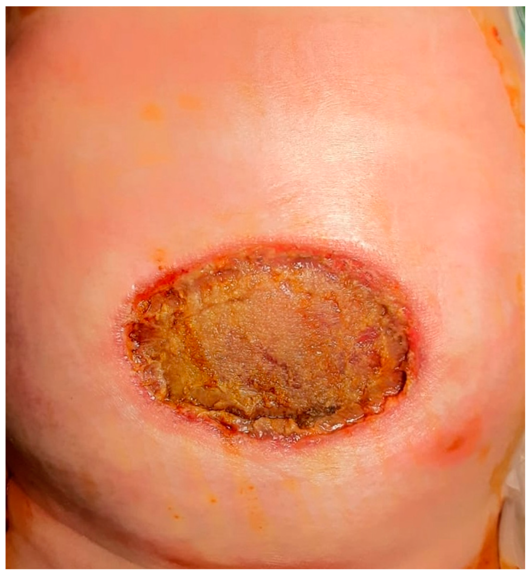 Complications 02 00004 g003