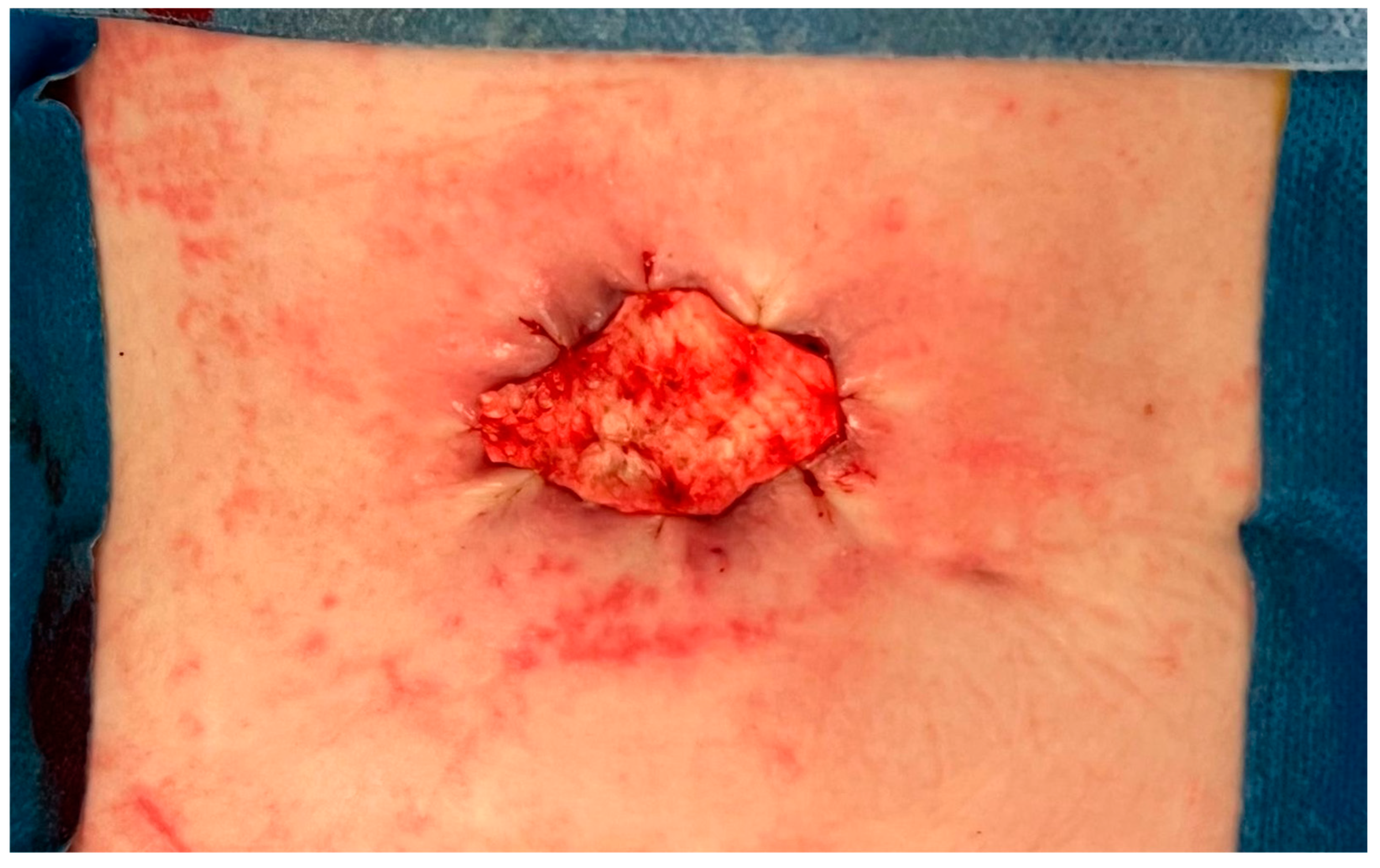 Complications 02 00004 g007