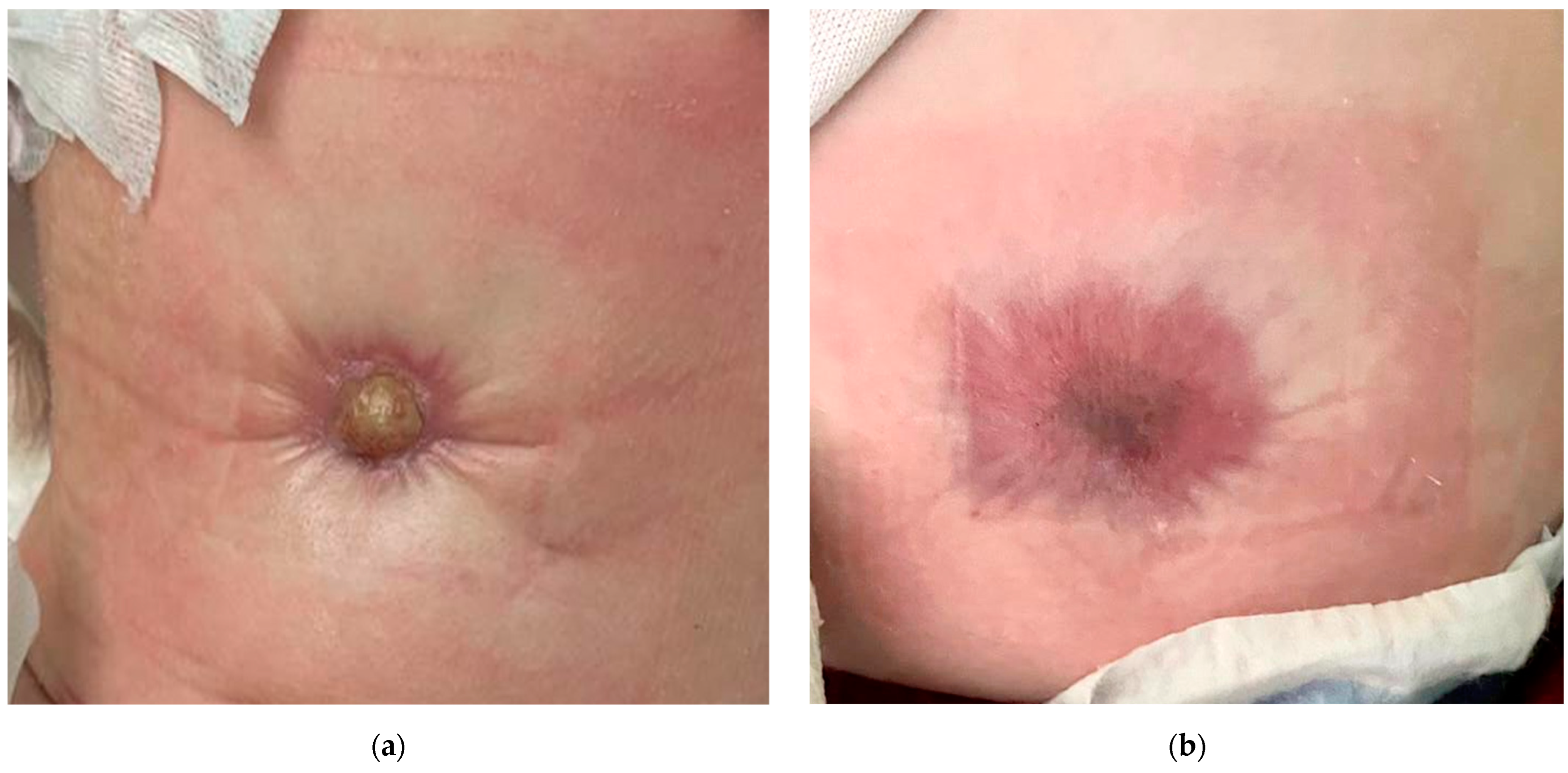 Complications 02 00004 g008