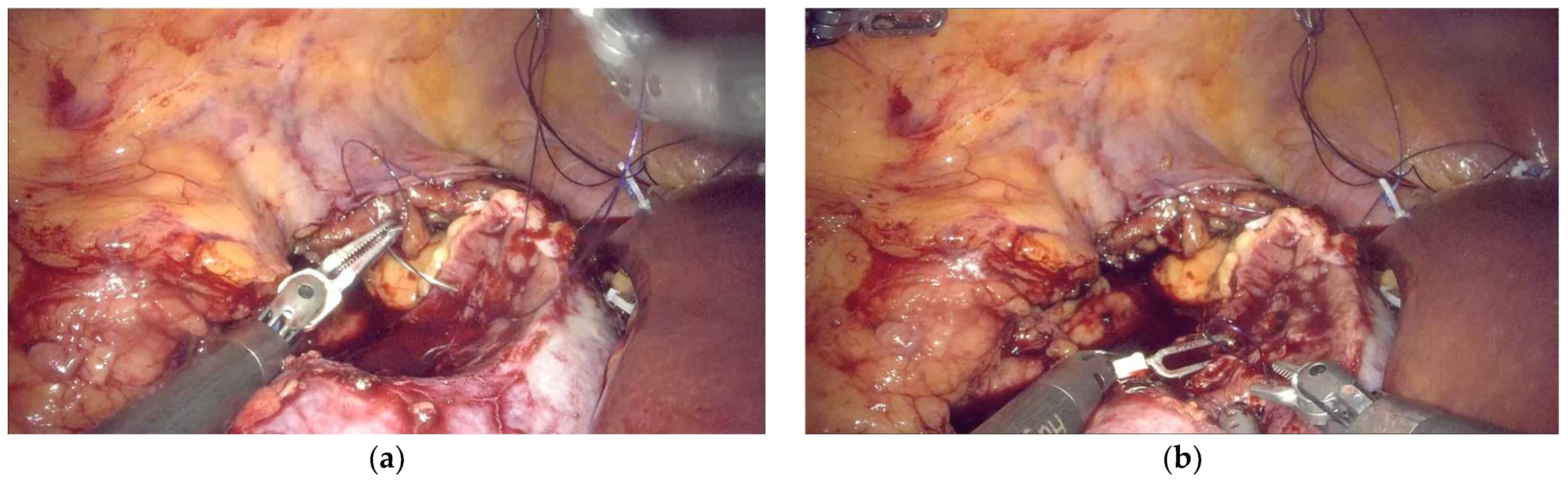 Complications 02 00021 g001a