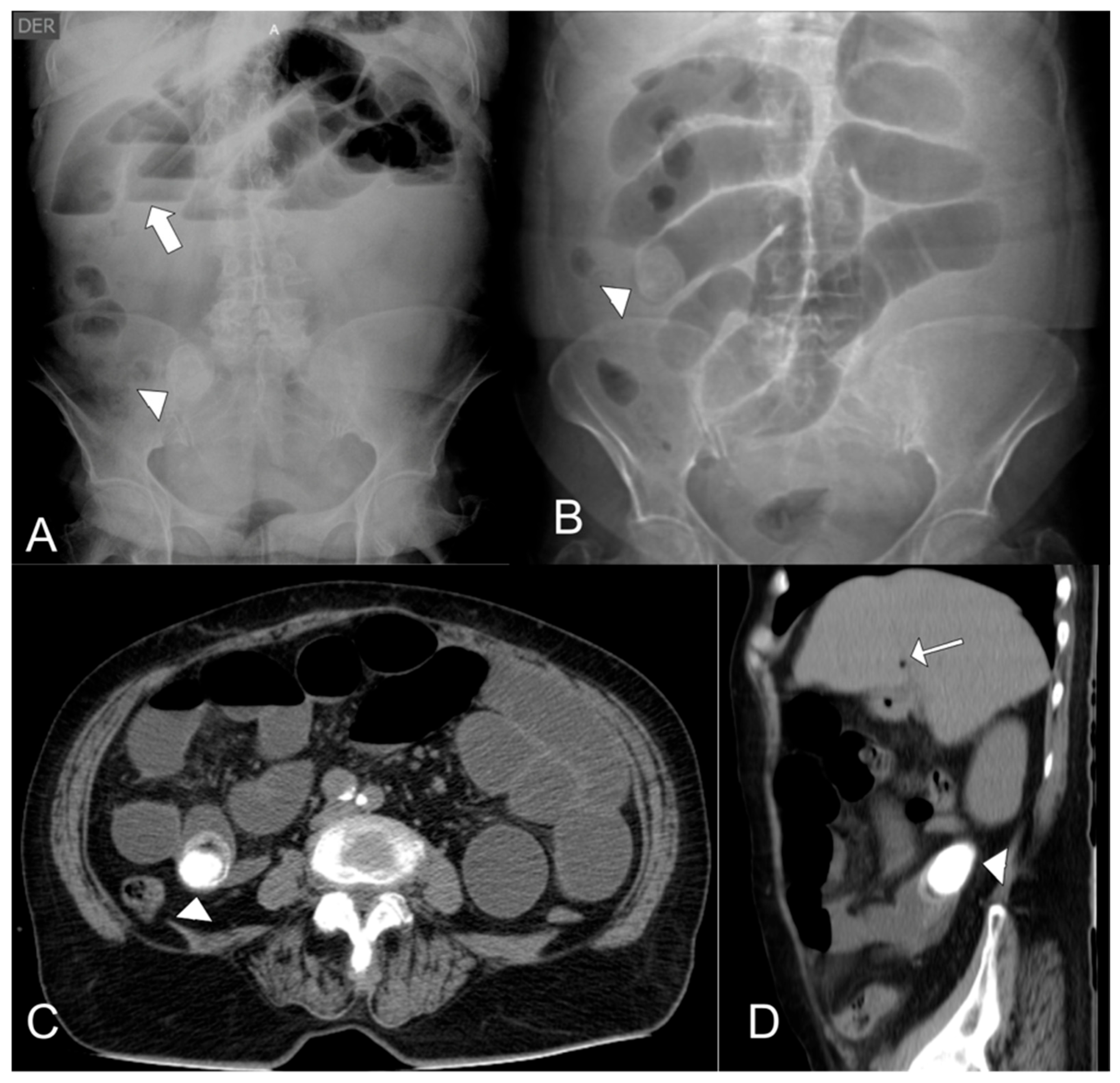 Complications 03 00002 g001