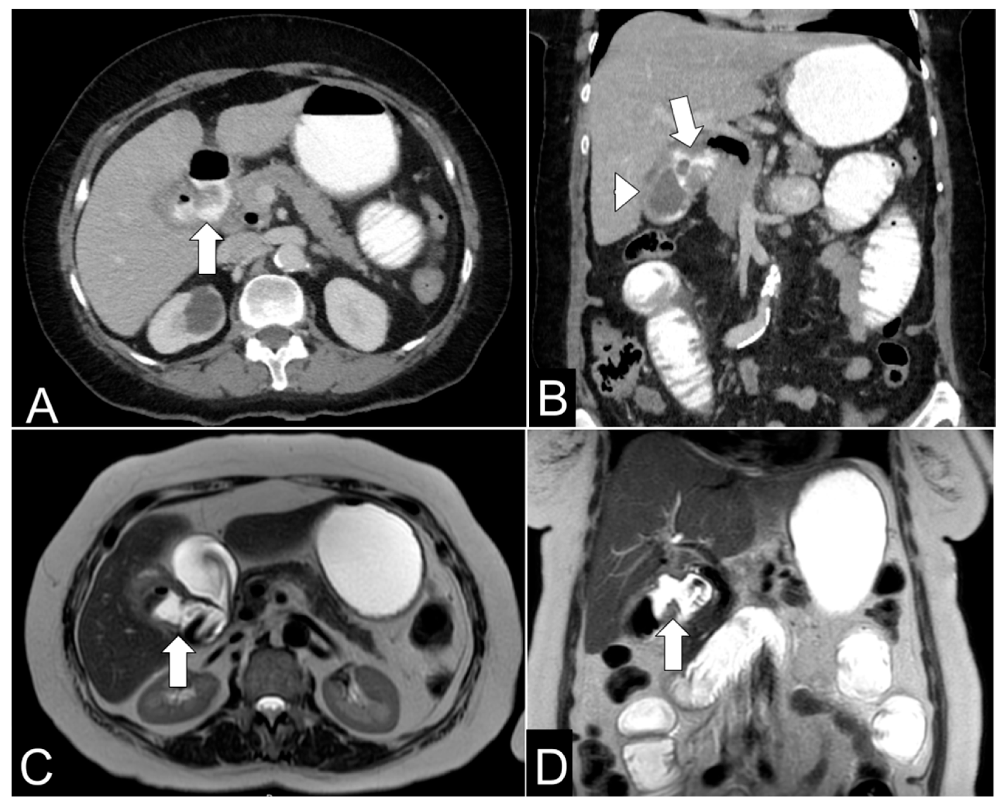 Complications 03 00002 g002