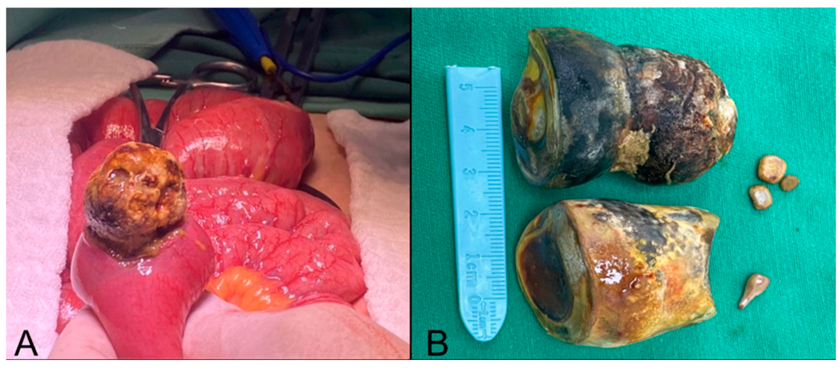 Complications 03 00002 g003