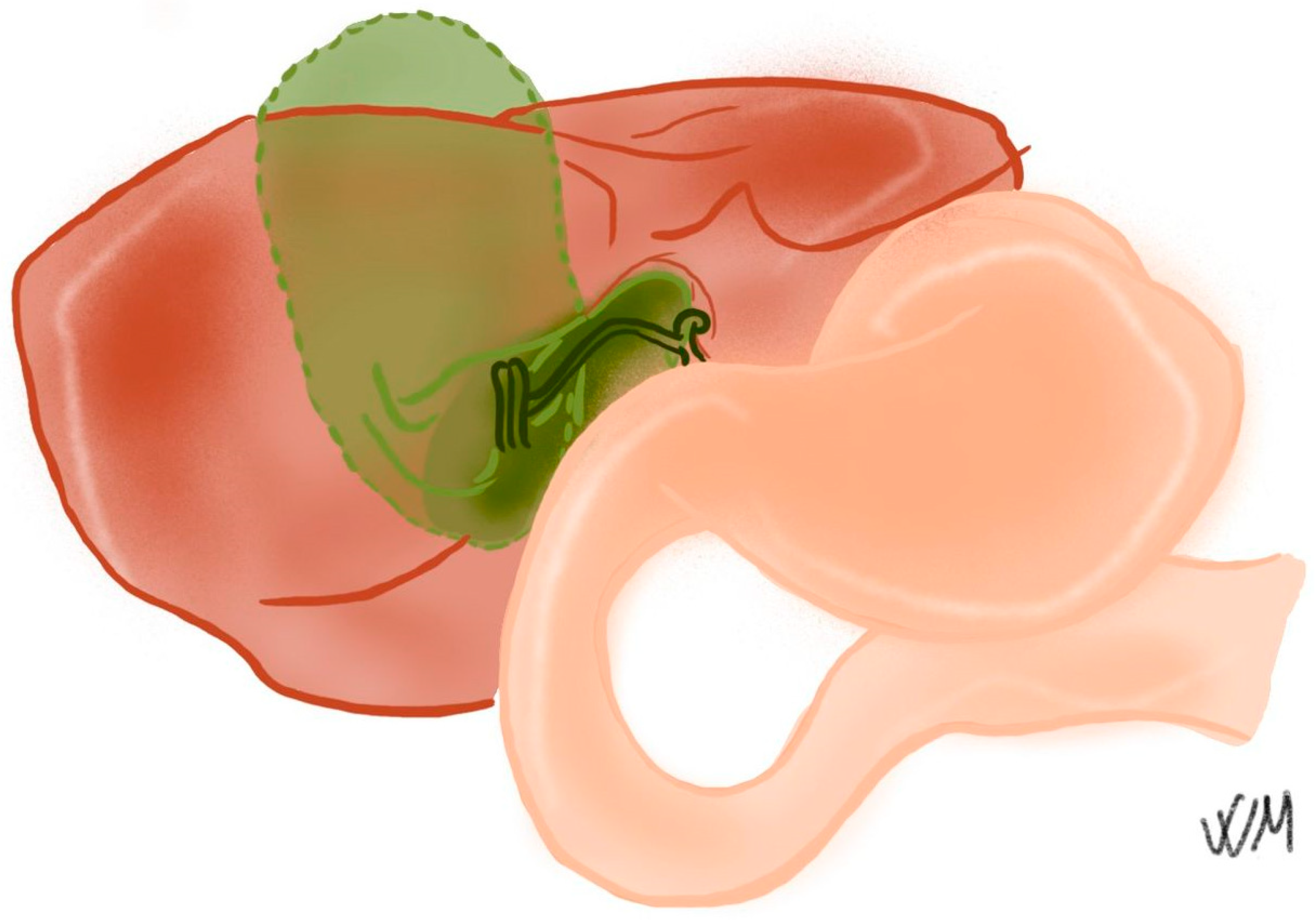 Complications 03 00002 g004a