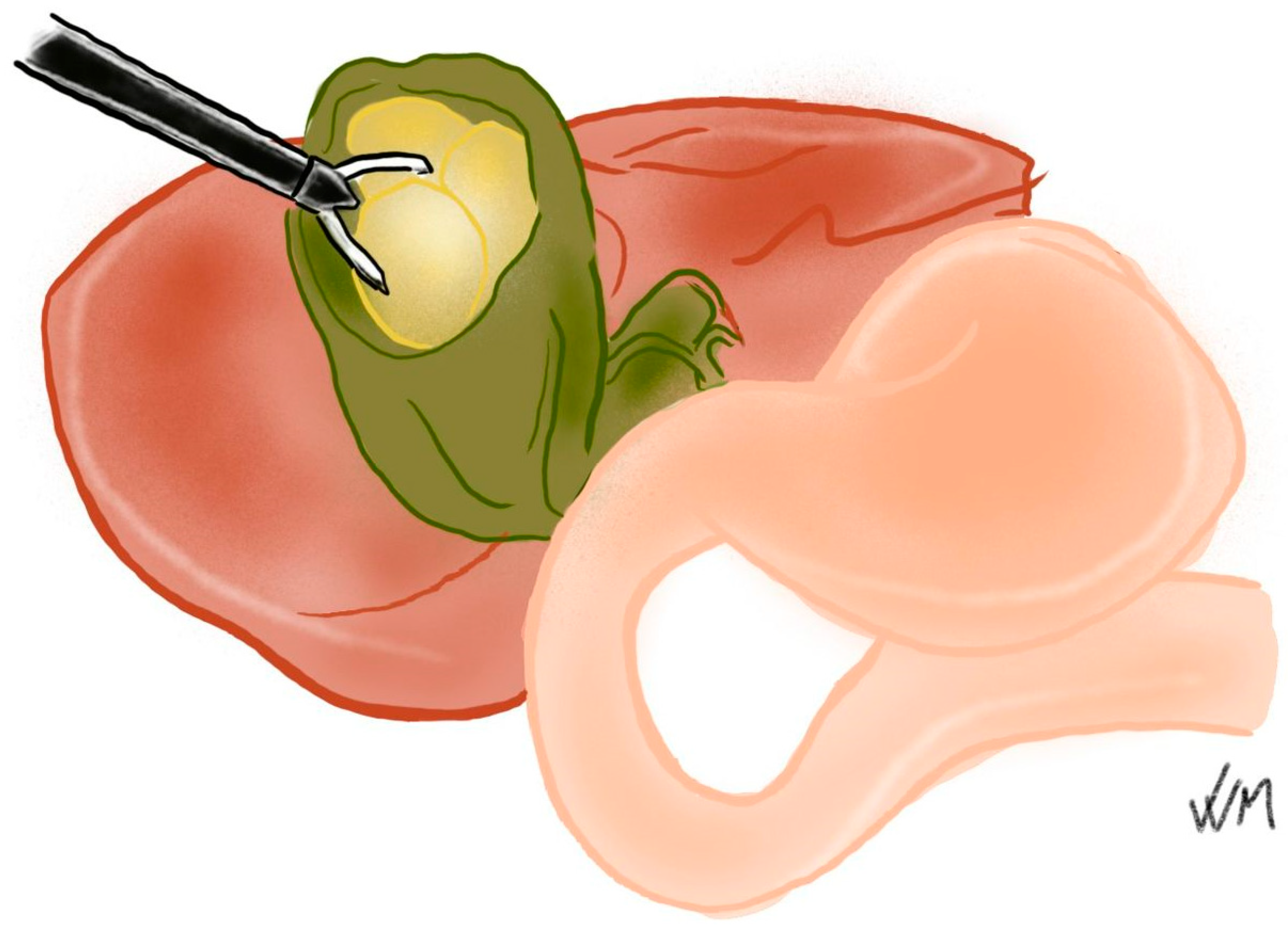 Complications 03 00002 g004b