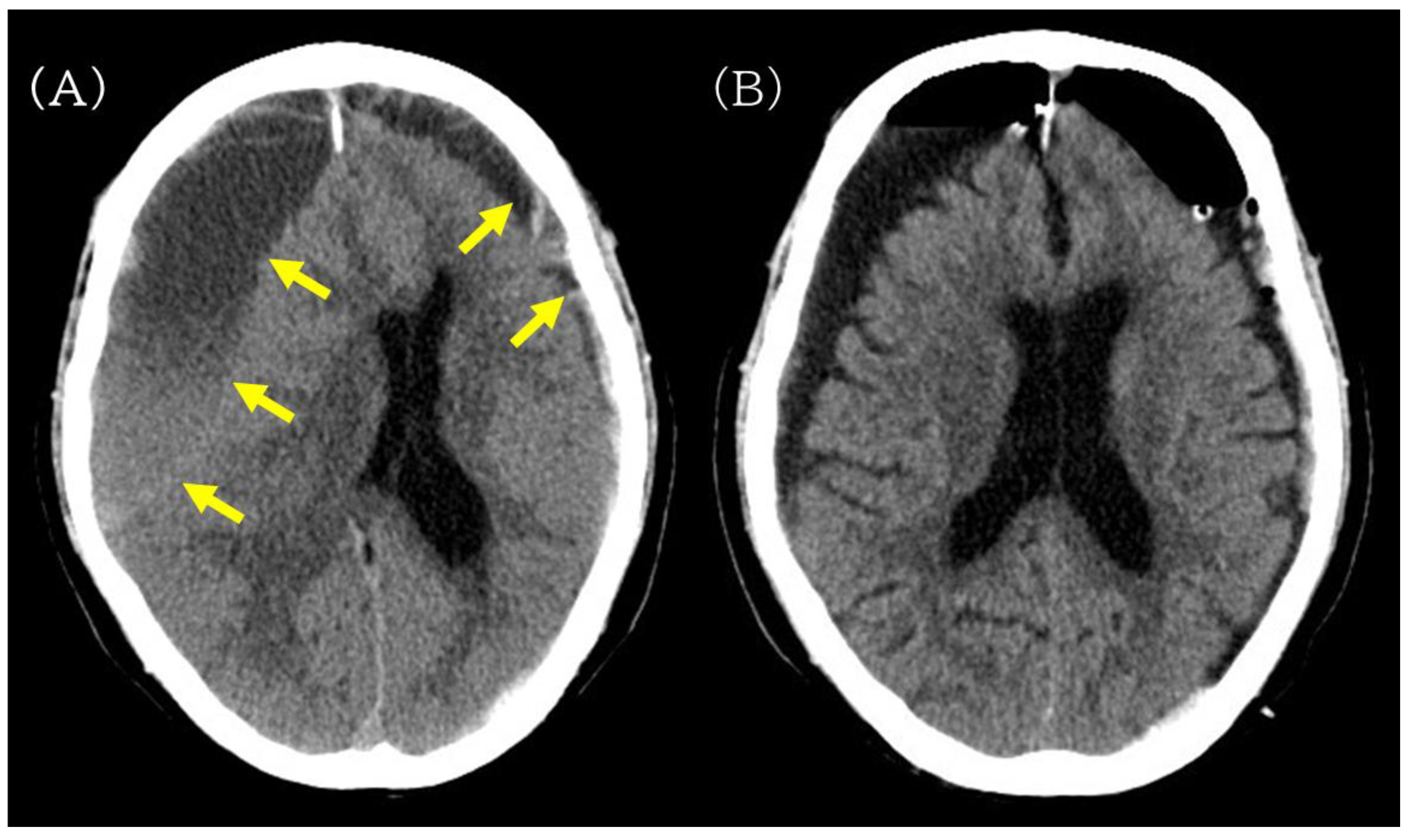 Complications 03 00004 g002
