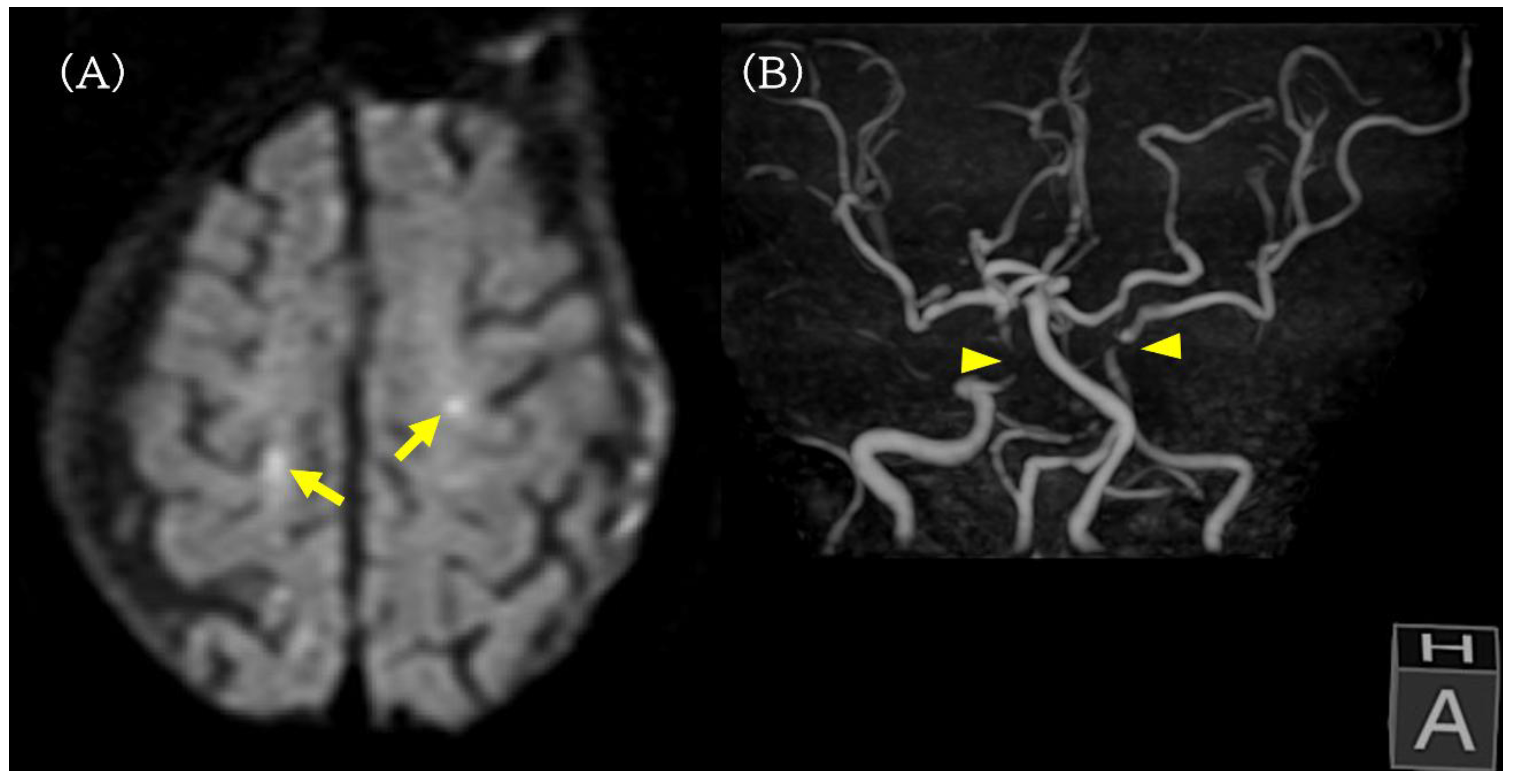 Complications 03 00004 g003
