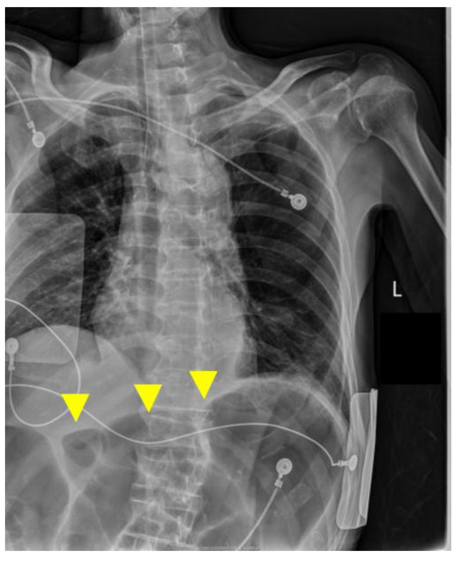 Complications 03 00004 g004