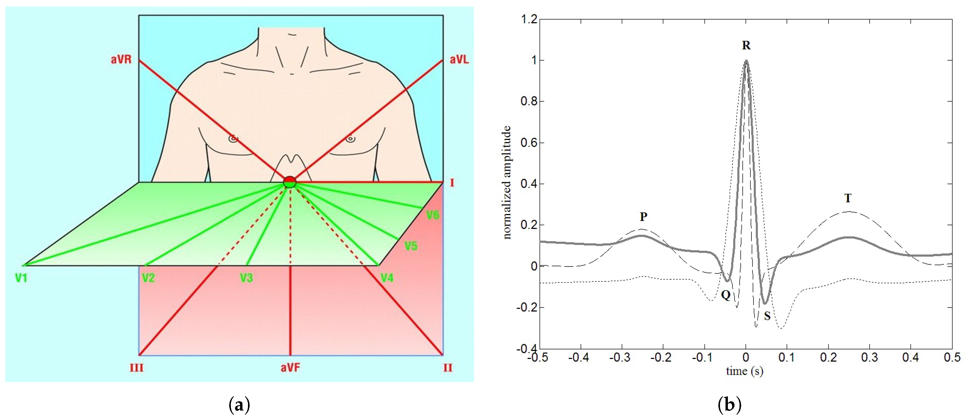 Computation 08 00092 g001