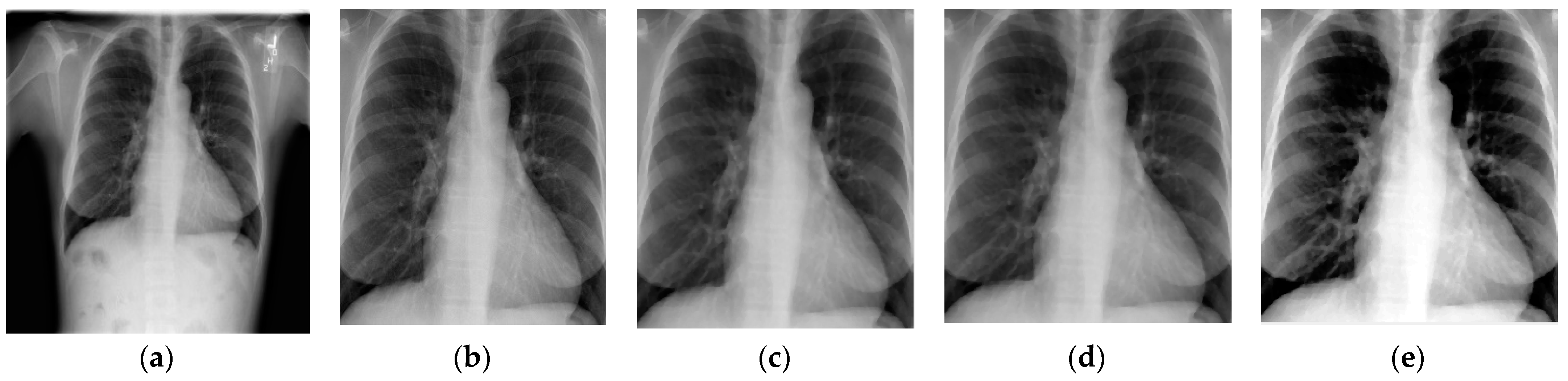 Performance Investigation for Medical Image Evaluation and Diagnosis ...