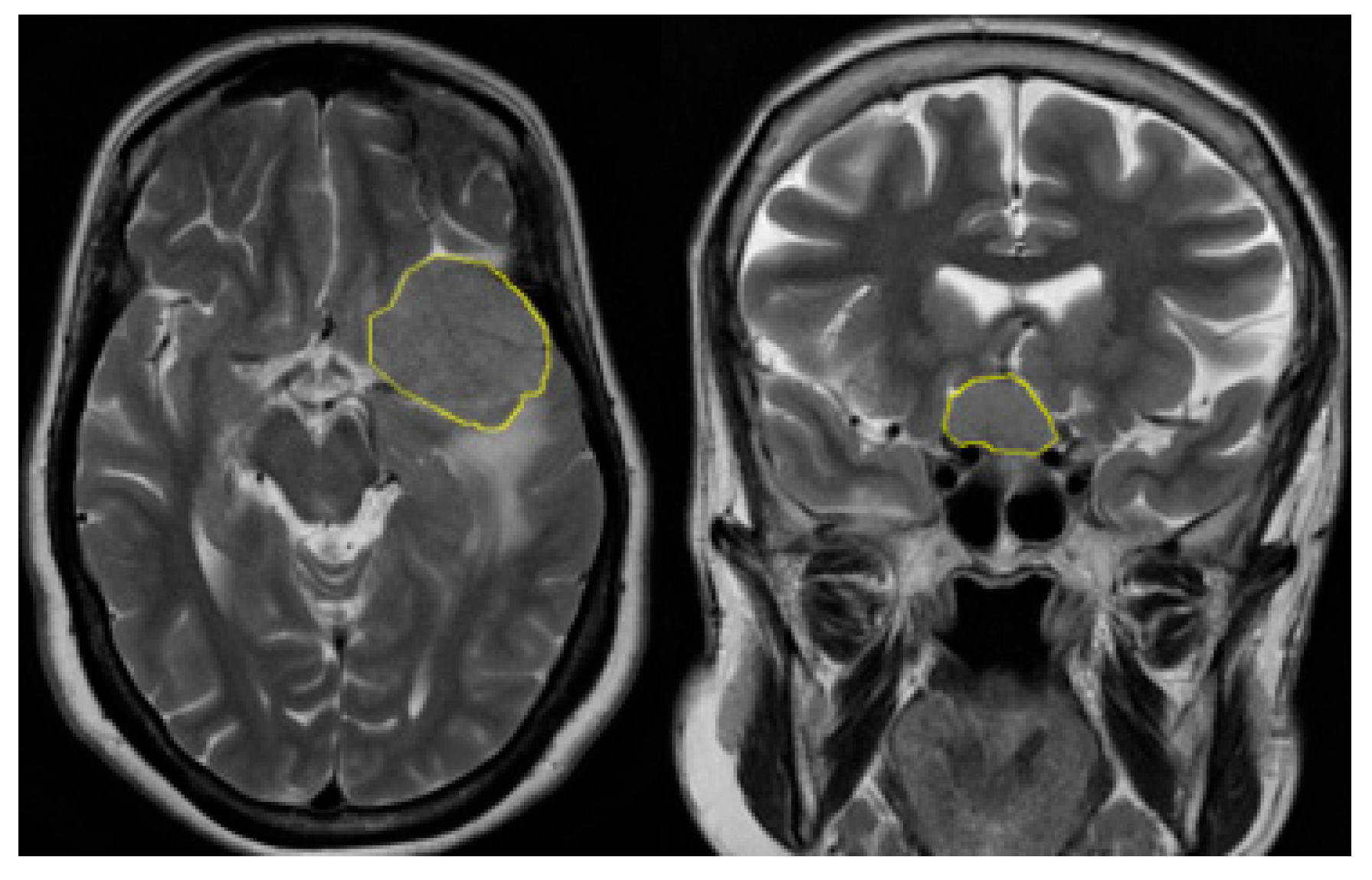 Computation 12 00044 g001