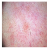 Computation 12 00173 i034