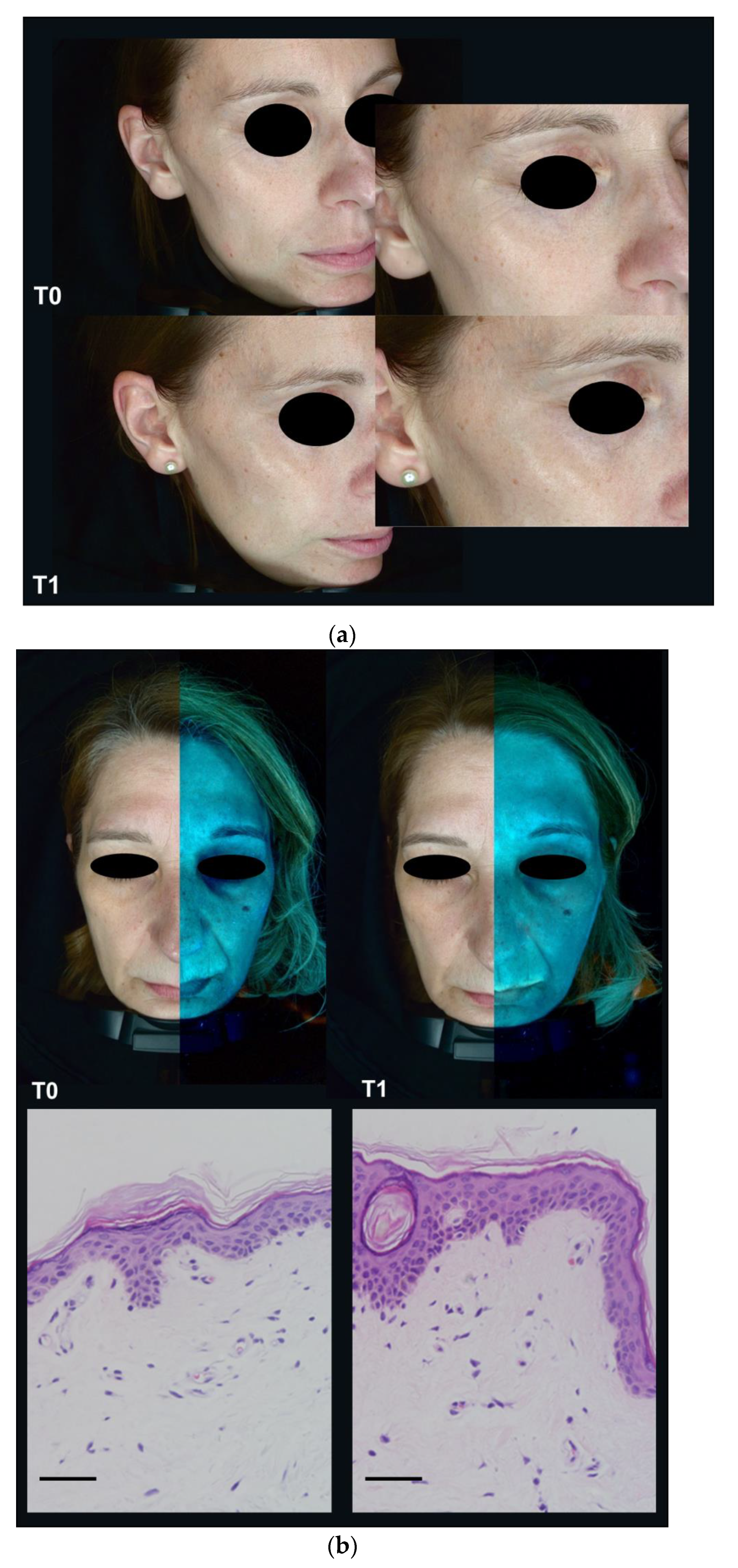 Cosmetics 08 00016 g004a