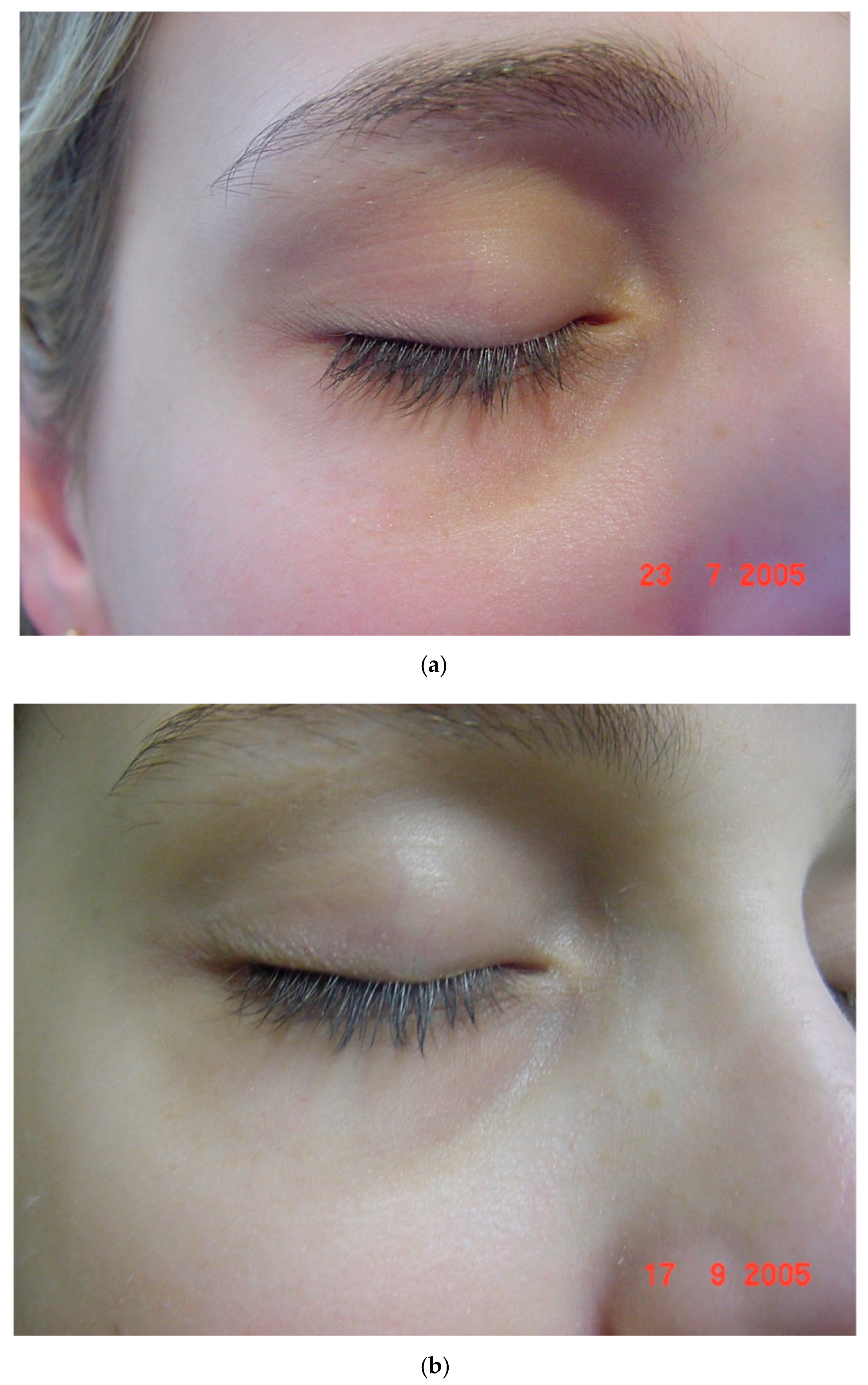 Cosmetics 08 00026 g003