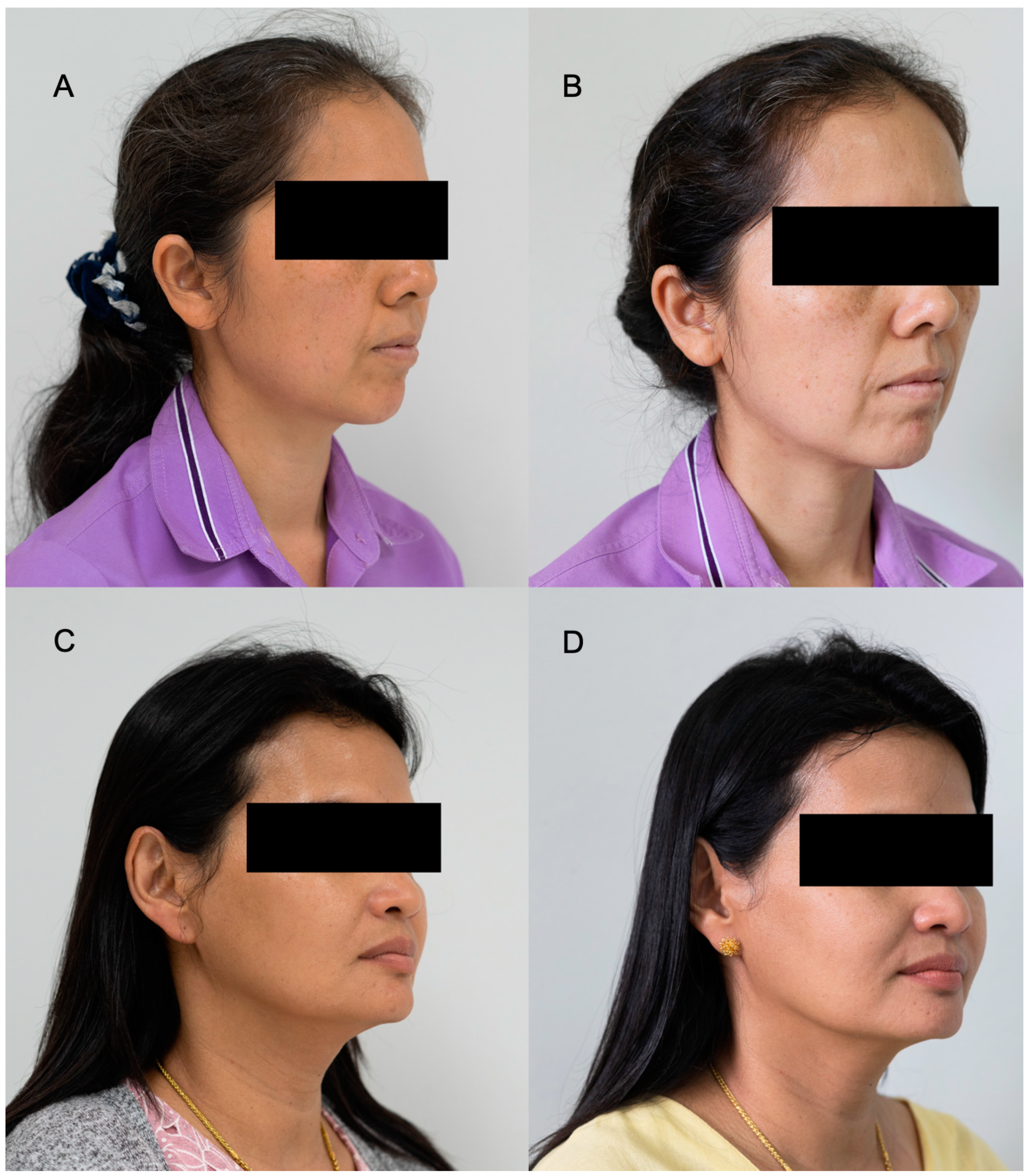 Cosmetics 09 00003 g008