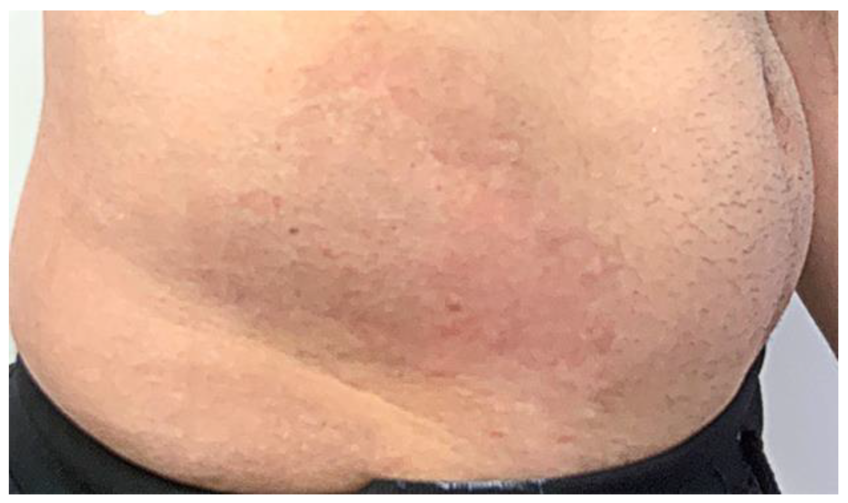 Cosmetics 09 00010 g004