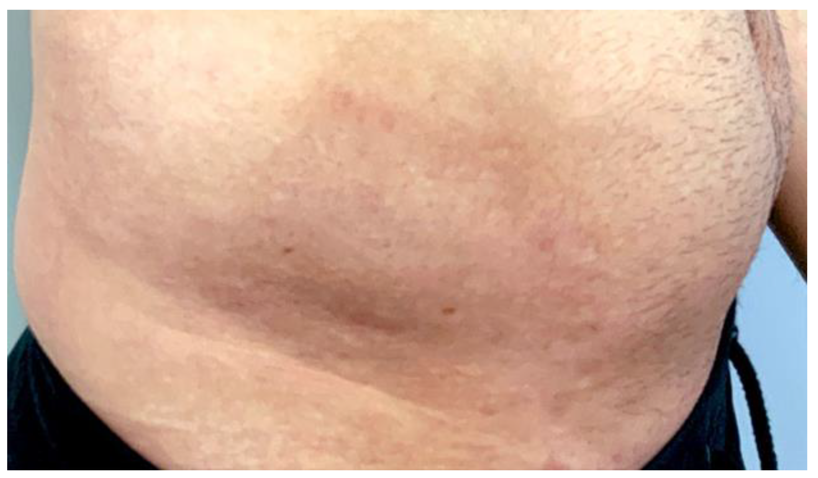 Cosmetics 09 00010 g005