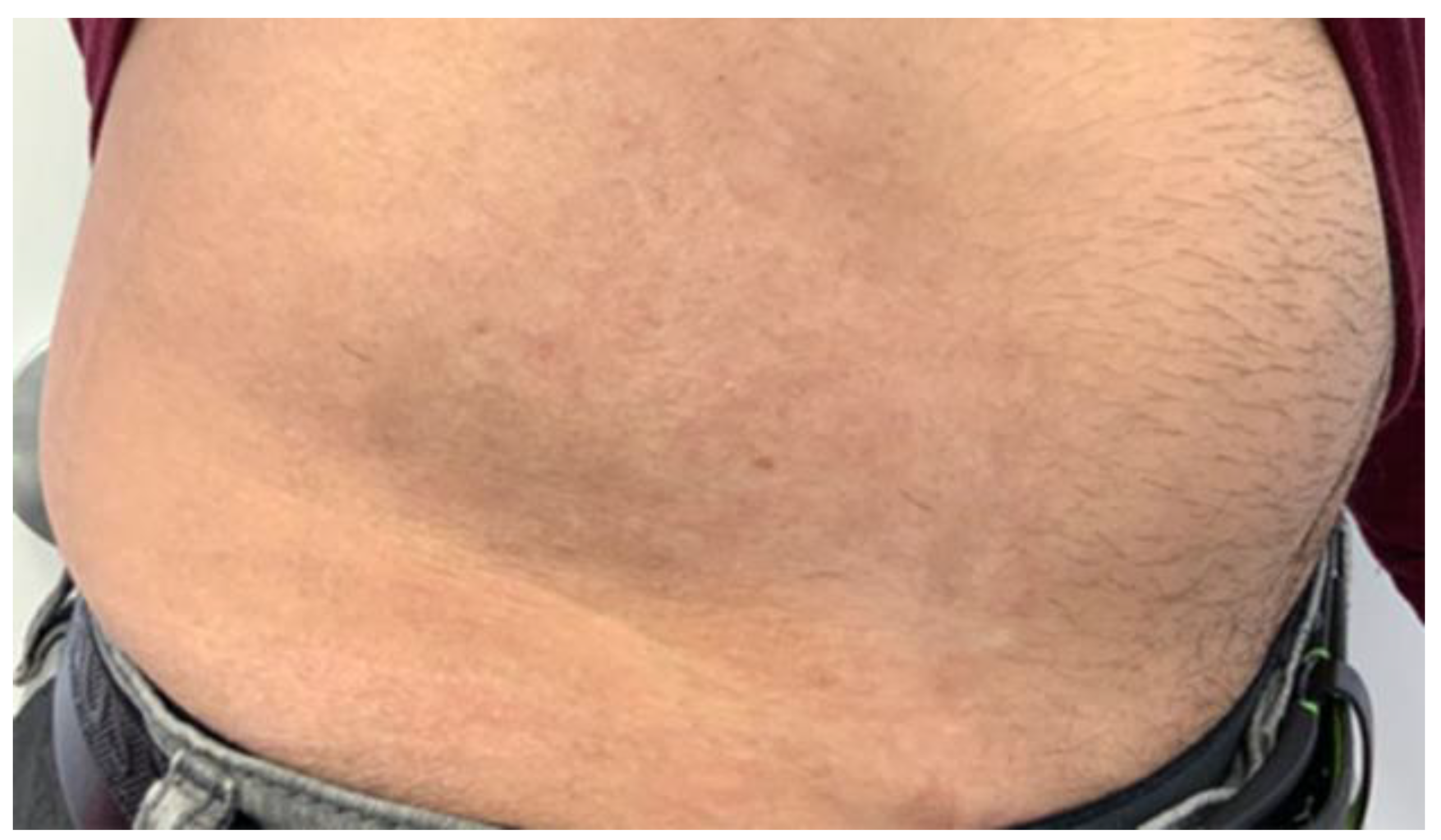 Cosmetics 09 00010 g006