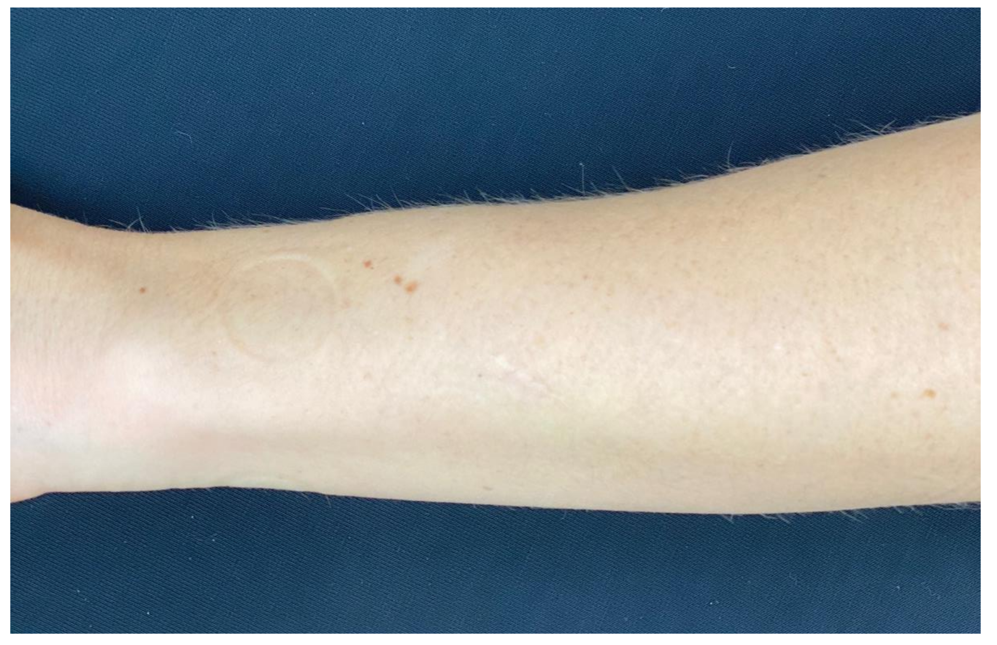 Cosmetics 09 00028 g003