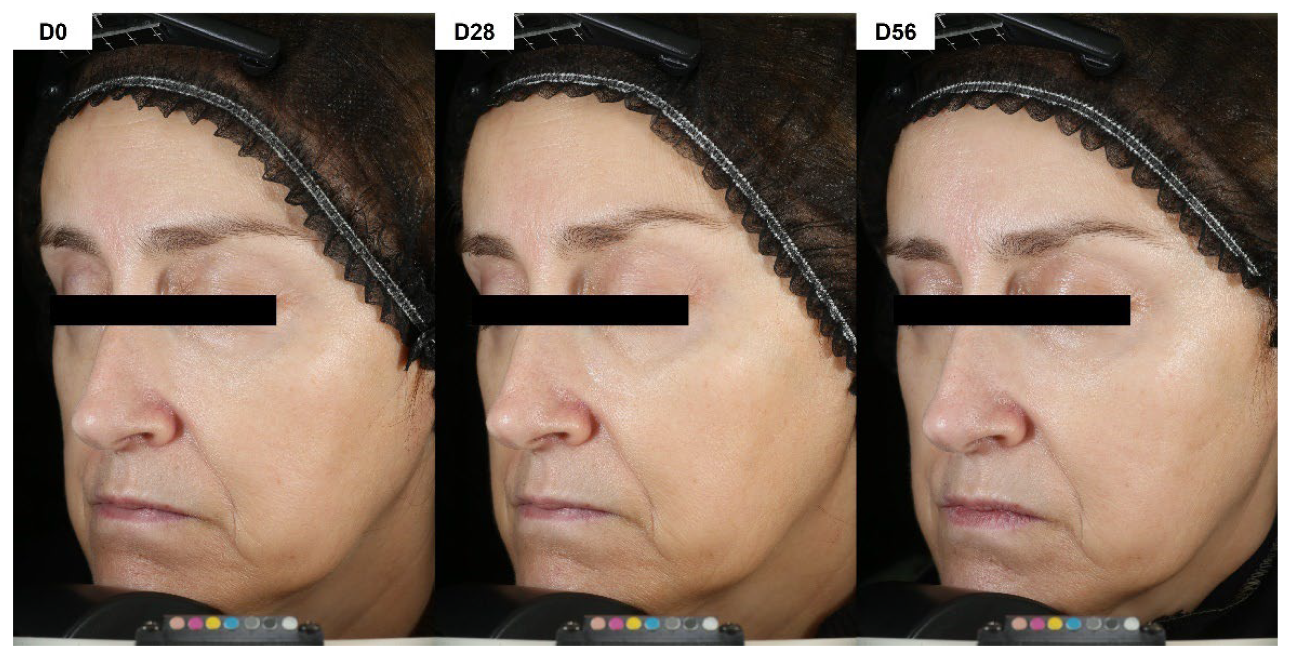 Cosmetics 09 00074 g002