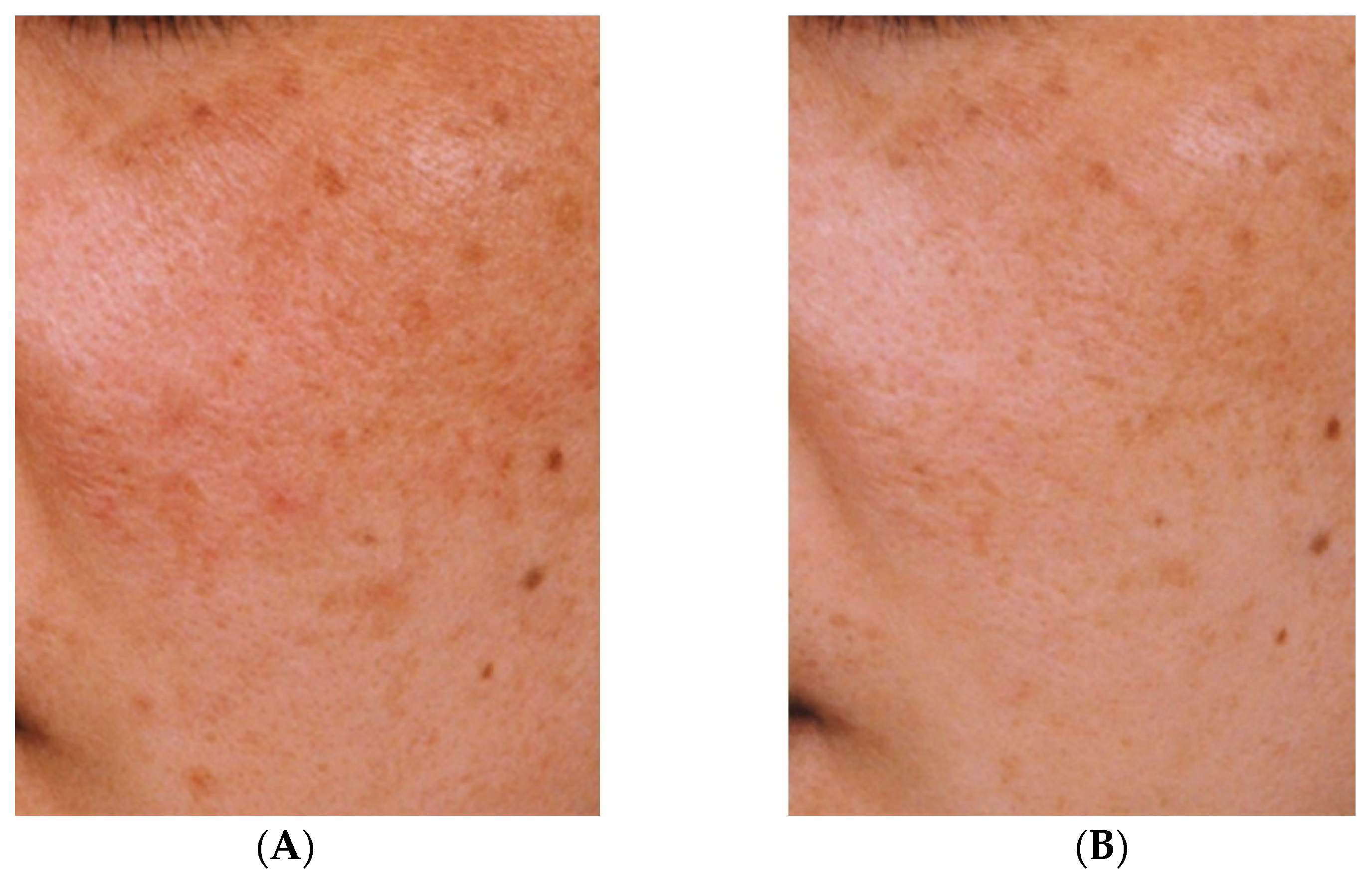 Cosmetics 09 00108 g002