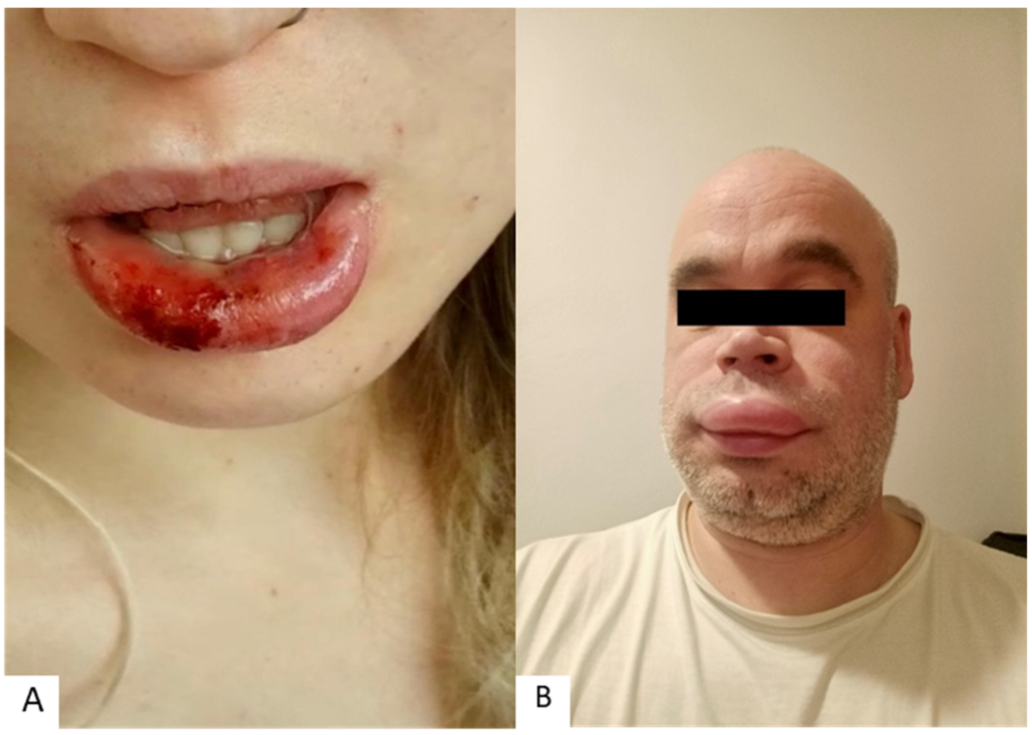 Cosmetics 10 00009 g003 Cosmetics 10 00009 g003