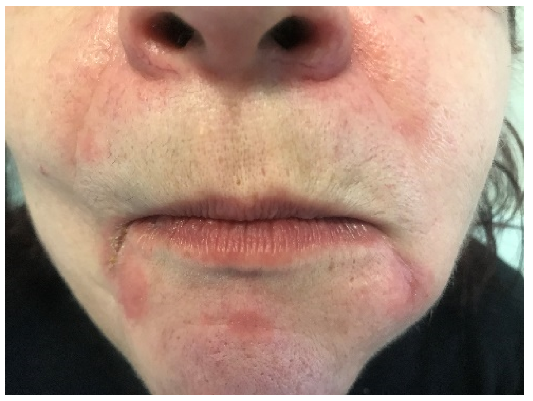 Cosmetics 10 00009 g004 Cosmetics 10 00009 g004