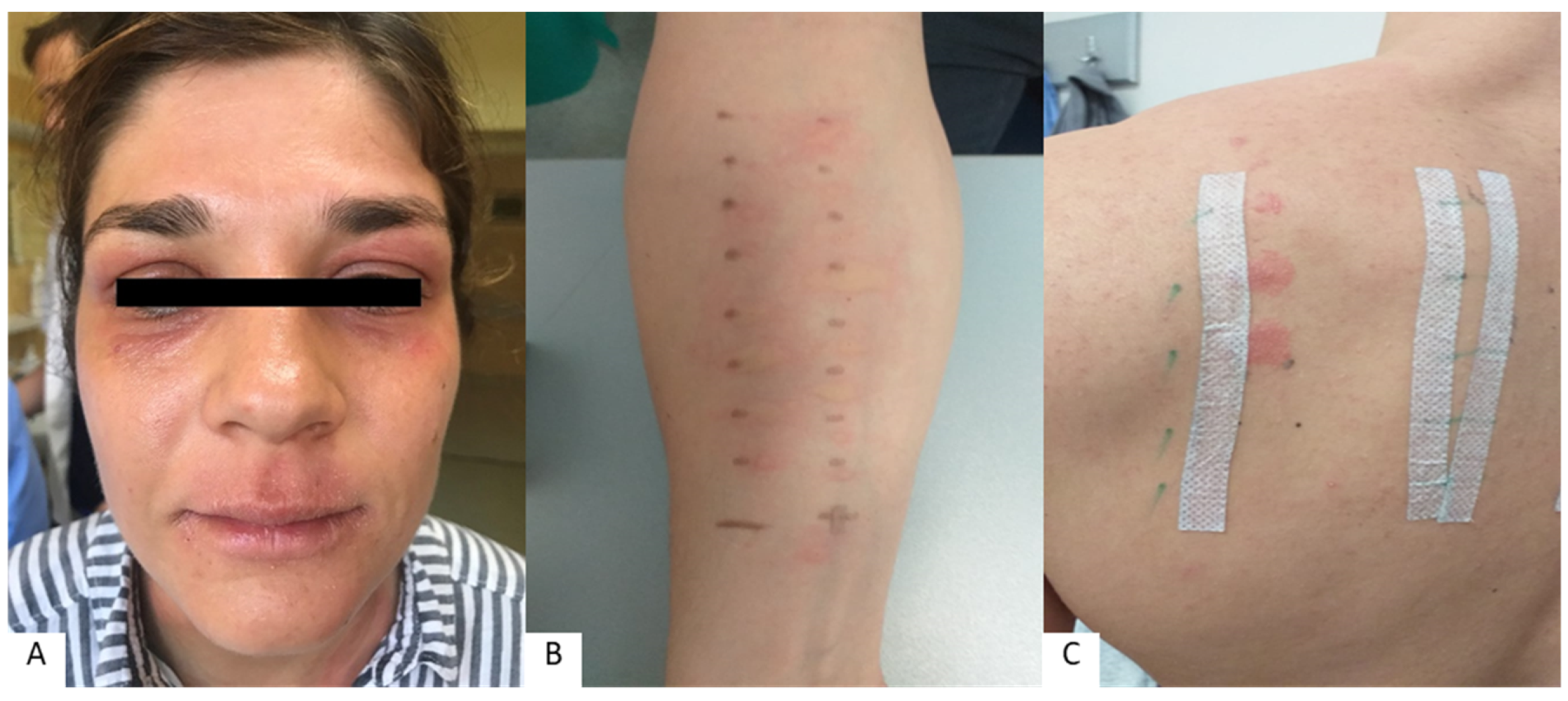 Cosmetics 10 00009 g005 Cosmetics 10 00009 g005