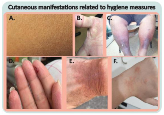 Cosmetics 10 00034 g004