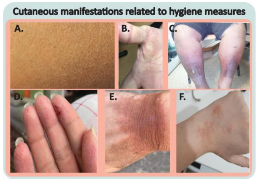 Cosmetics 10 00034 g004