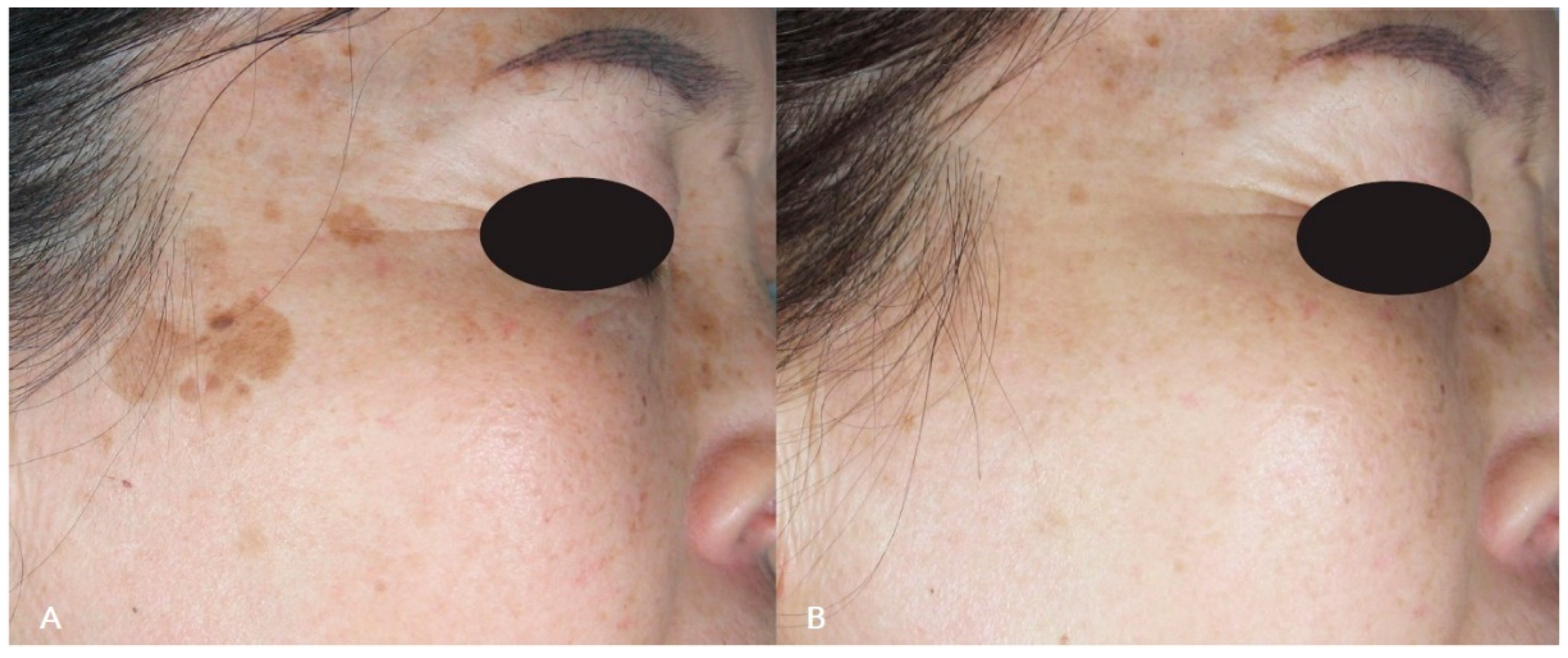 Cosmetics 10 00044 g003