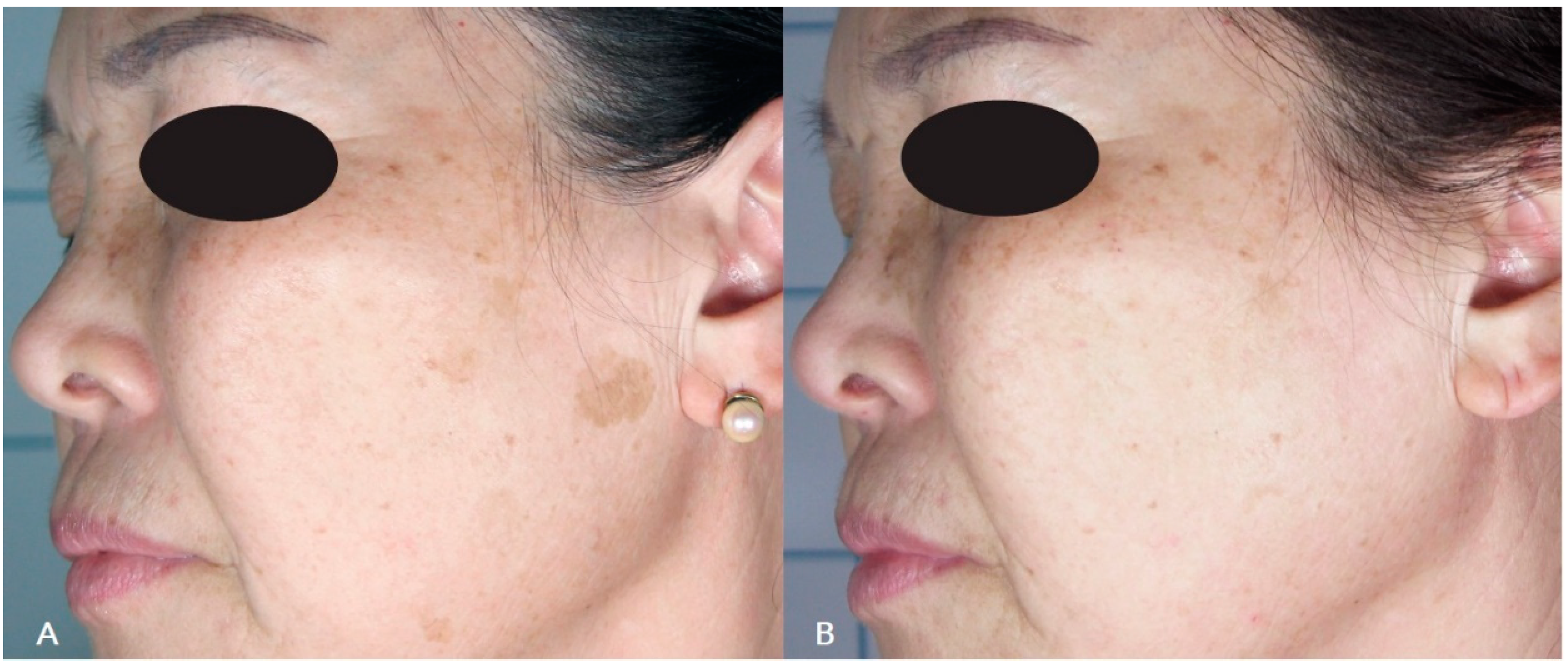 Cosmetics 10 00044 g004