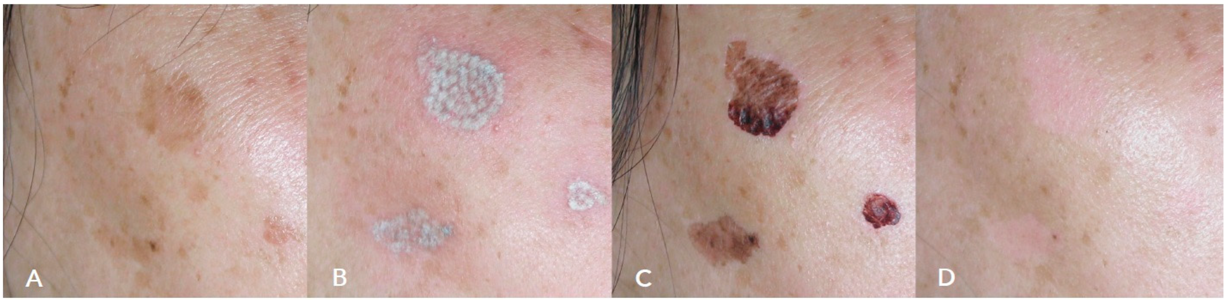 Cosmetics 10 00044 g005