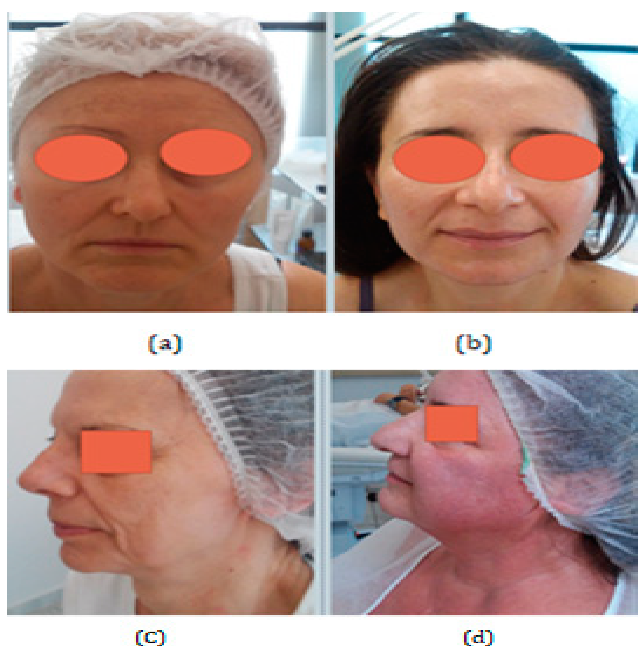 Cosmetics 10 00048 g002