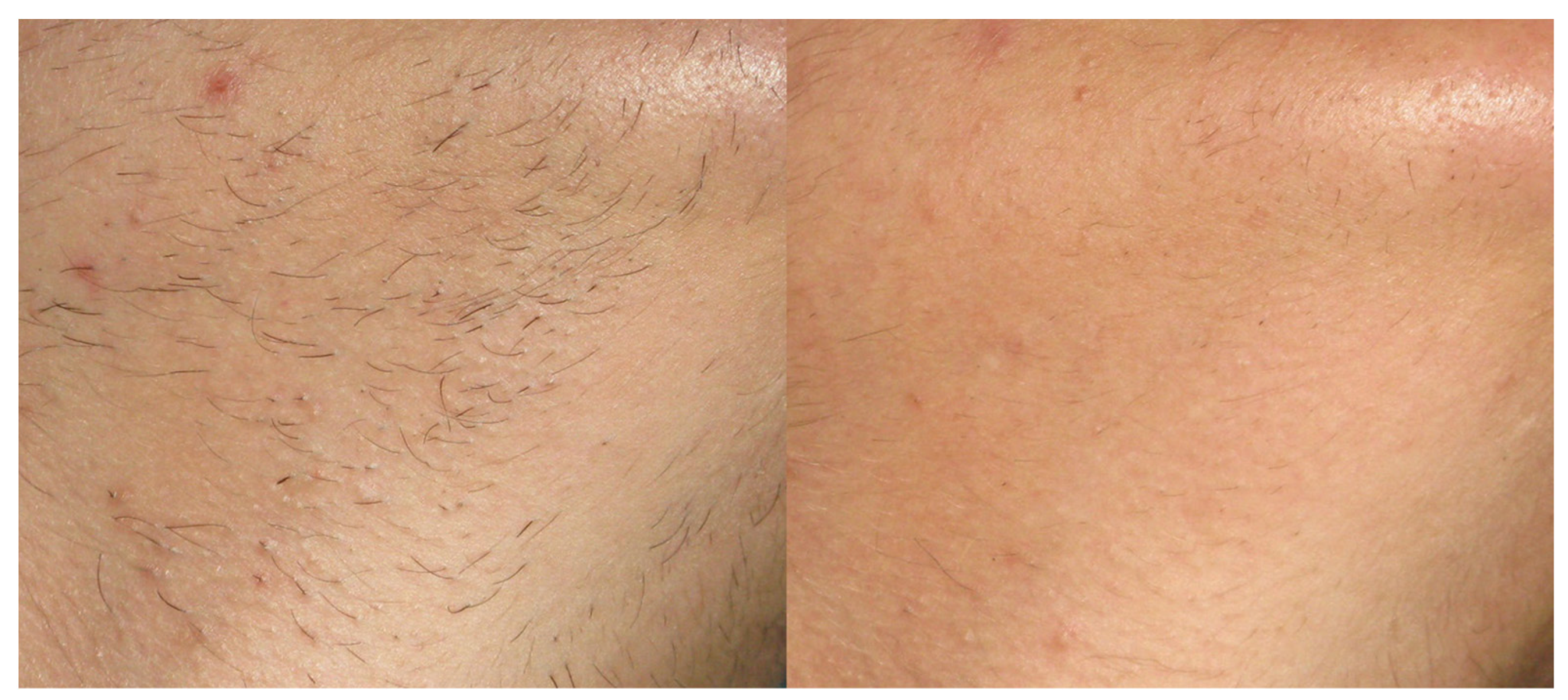 Cosmetics 10 00059 g002