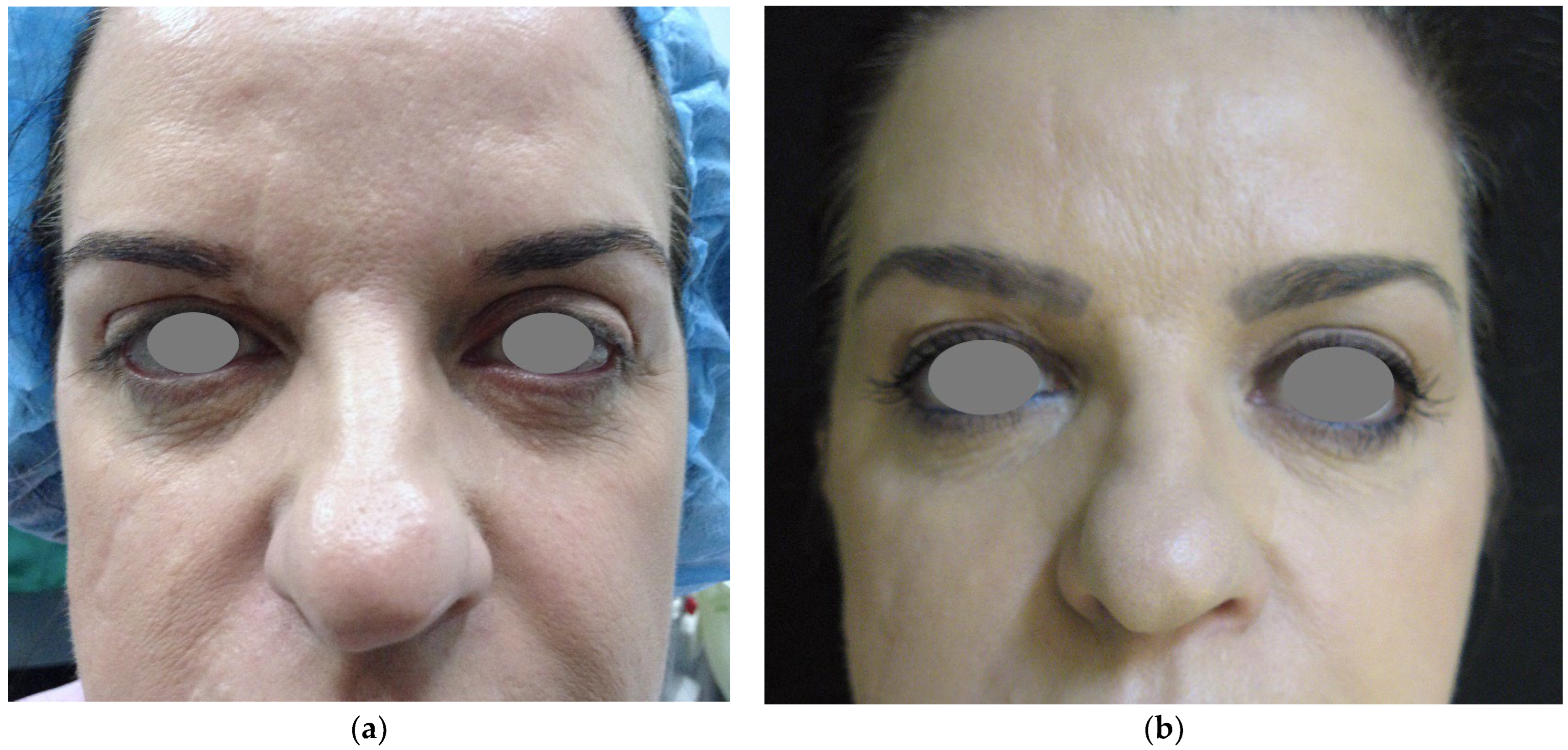 Cosmetics 10 00061 g002