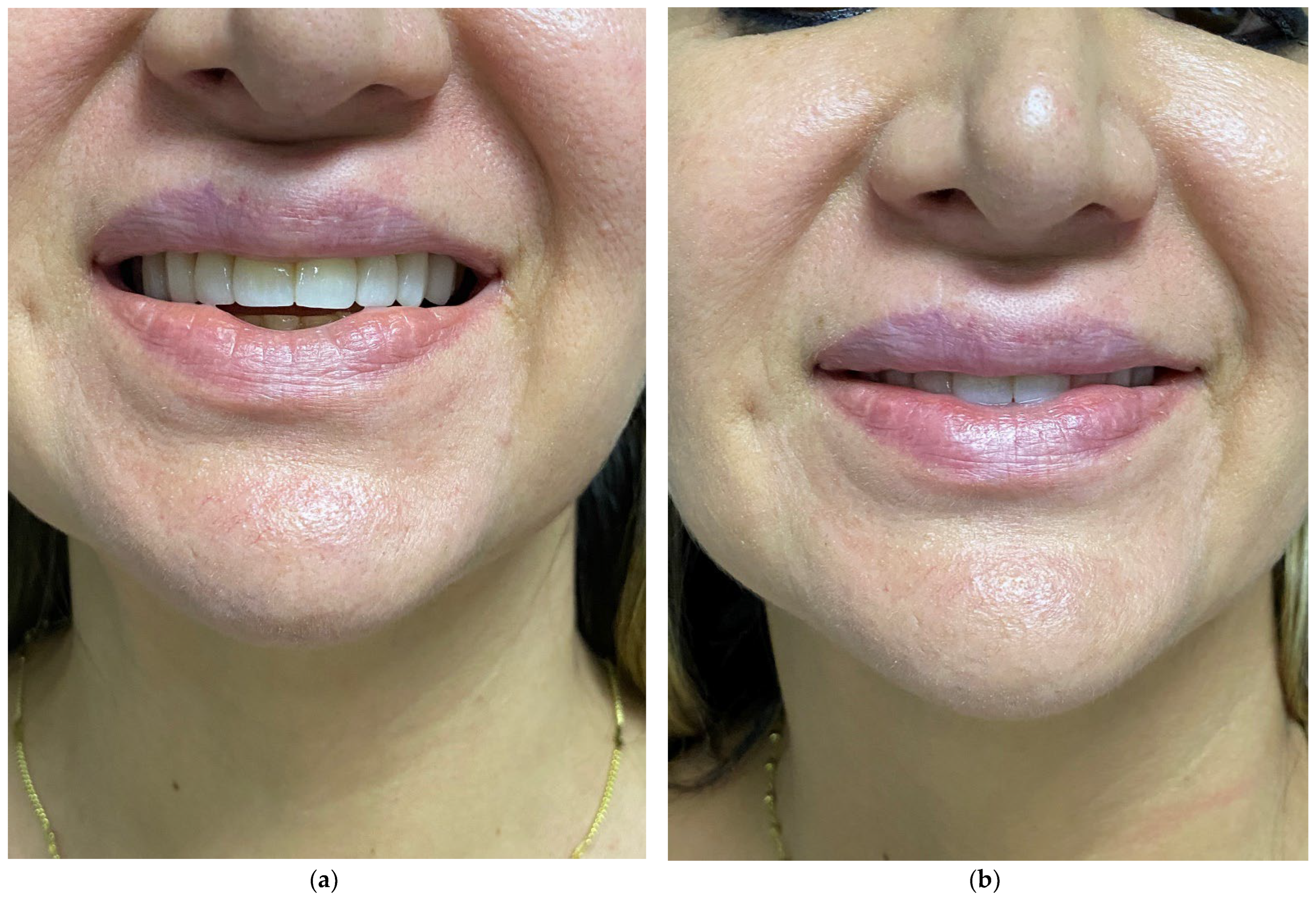 Cosmetics 10 00061 g003