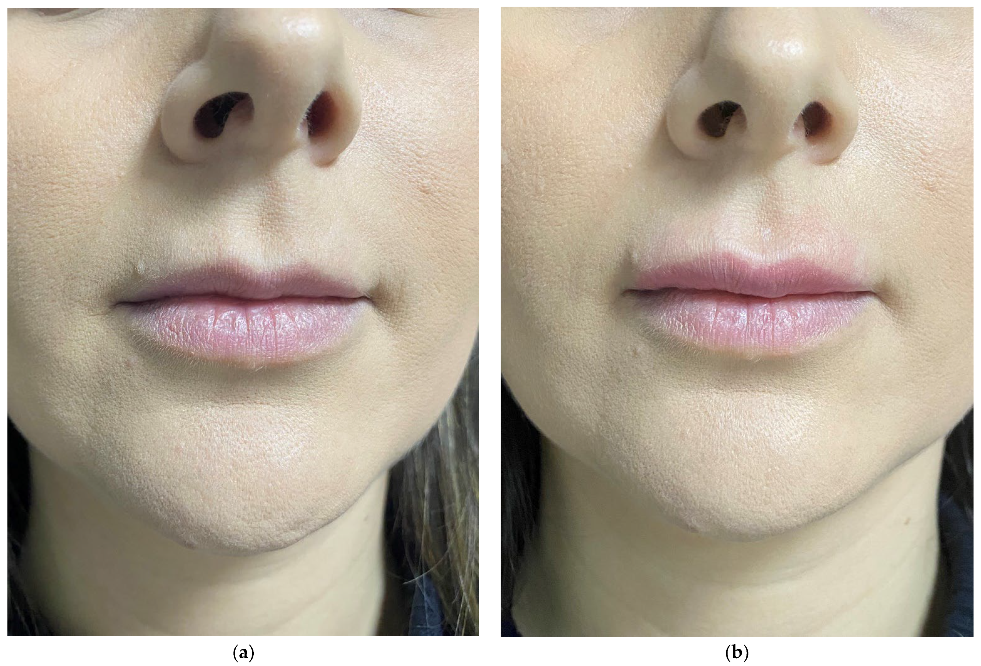 Cosmetics 10 00061 g004