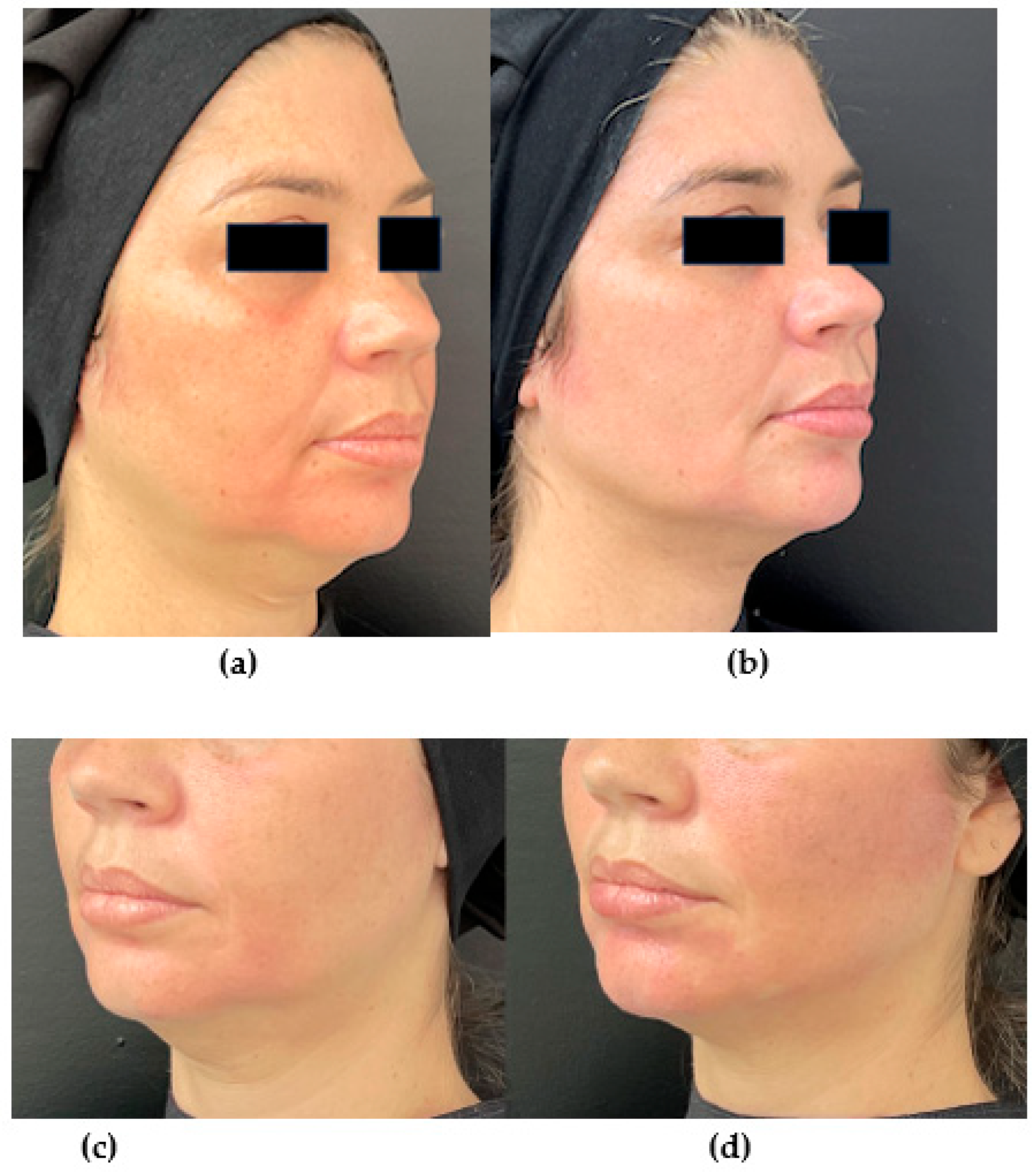 Cosmetics 10 00105 g001 Cosmetics 10 00105 g001