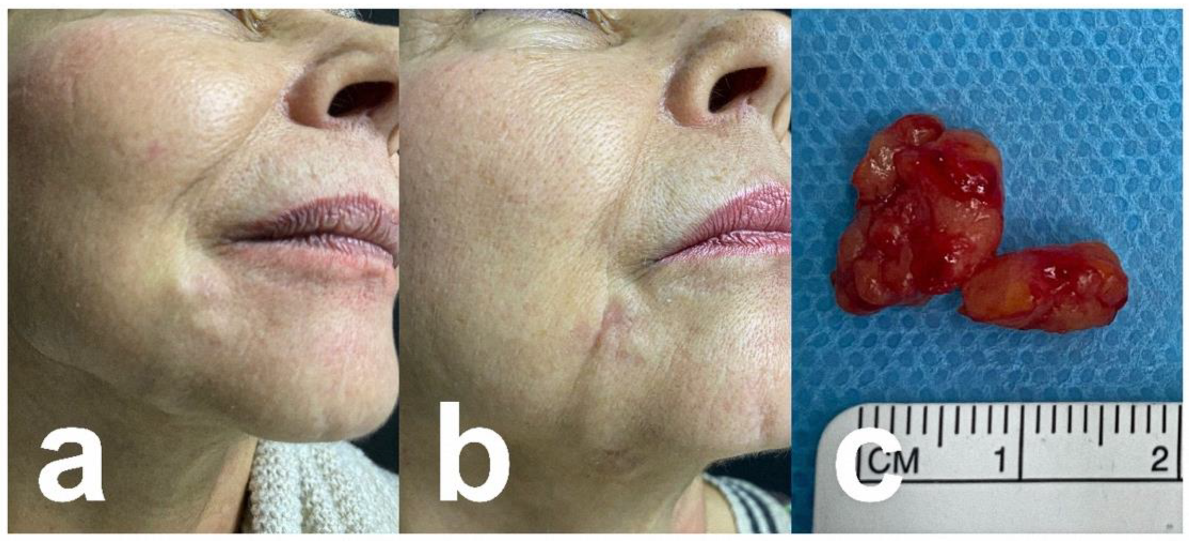 Cosmetics 10 00115 g004